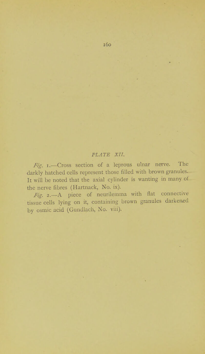 i6o PLATE XII. Fig. i.—Cross section of a leprous ulnar nerve. The darkly hatched cells represent those rilled with brown granules. It will be noted that the axial cylinder is wanting in many ot the nerve fibres (Hartnack, No. ix). Fig. 2. A piece of neurilemma with flat connective tissue cells lying on it, containing brown granules darkened by osmic acid (Gundlach, No. viii).
