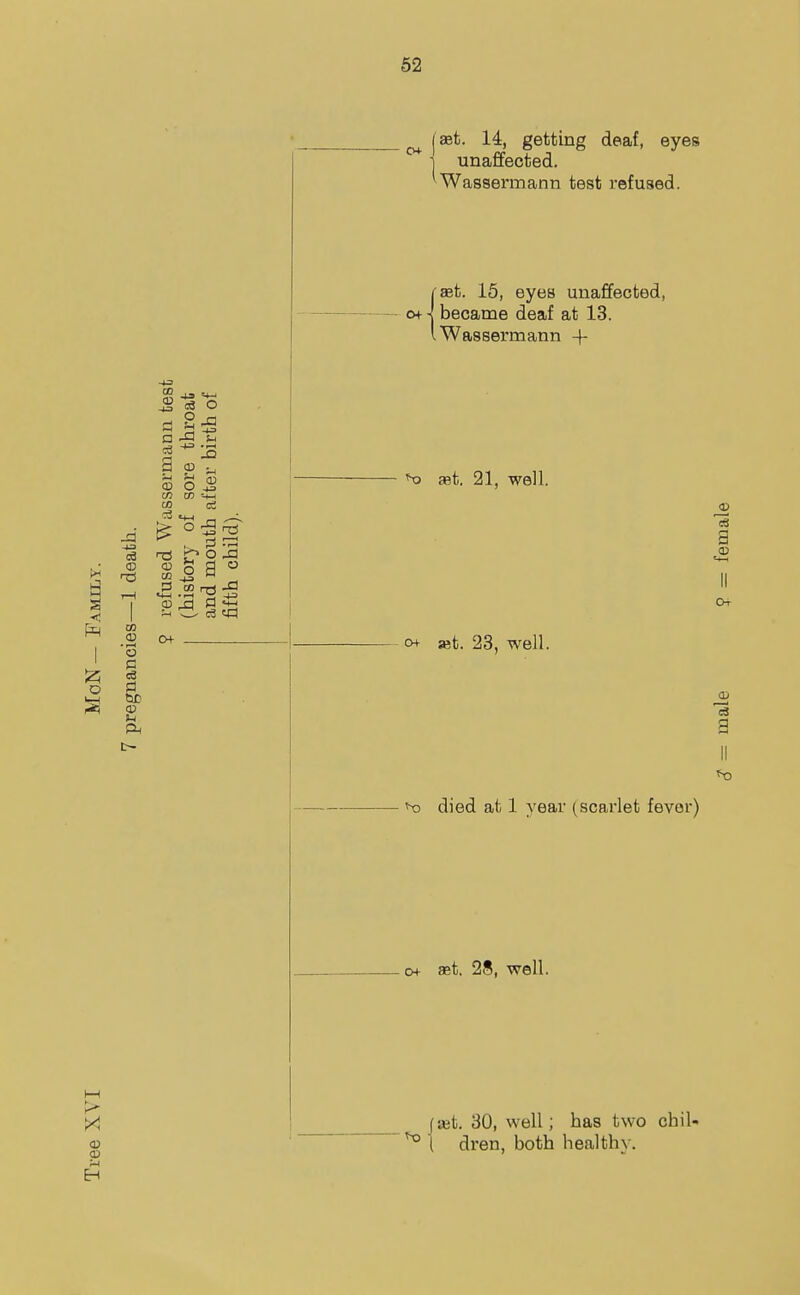 I ait. 14, getting deaf, eyes j unaffected. Wassermann test refused. 00 j3 s ^ a S □ Si a oj a> o OT CO CD r3 CO o -a S-i XI CD pi o a Pi r—H -a 4-1 «3 (•set. 15, eyes unaffected, o+ < became deaf at 13. I Wassermann + dst. 21, well. o+ set. 23, well. died at 1 year (scarlet fevor) . 0+ set. 28, well. f set. 30, well; has two '^l dren, both healthy. chil