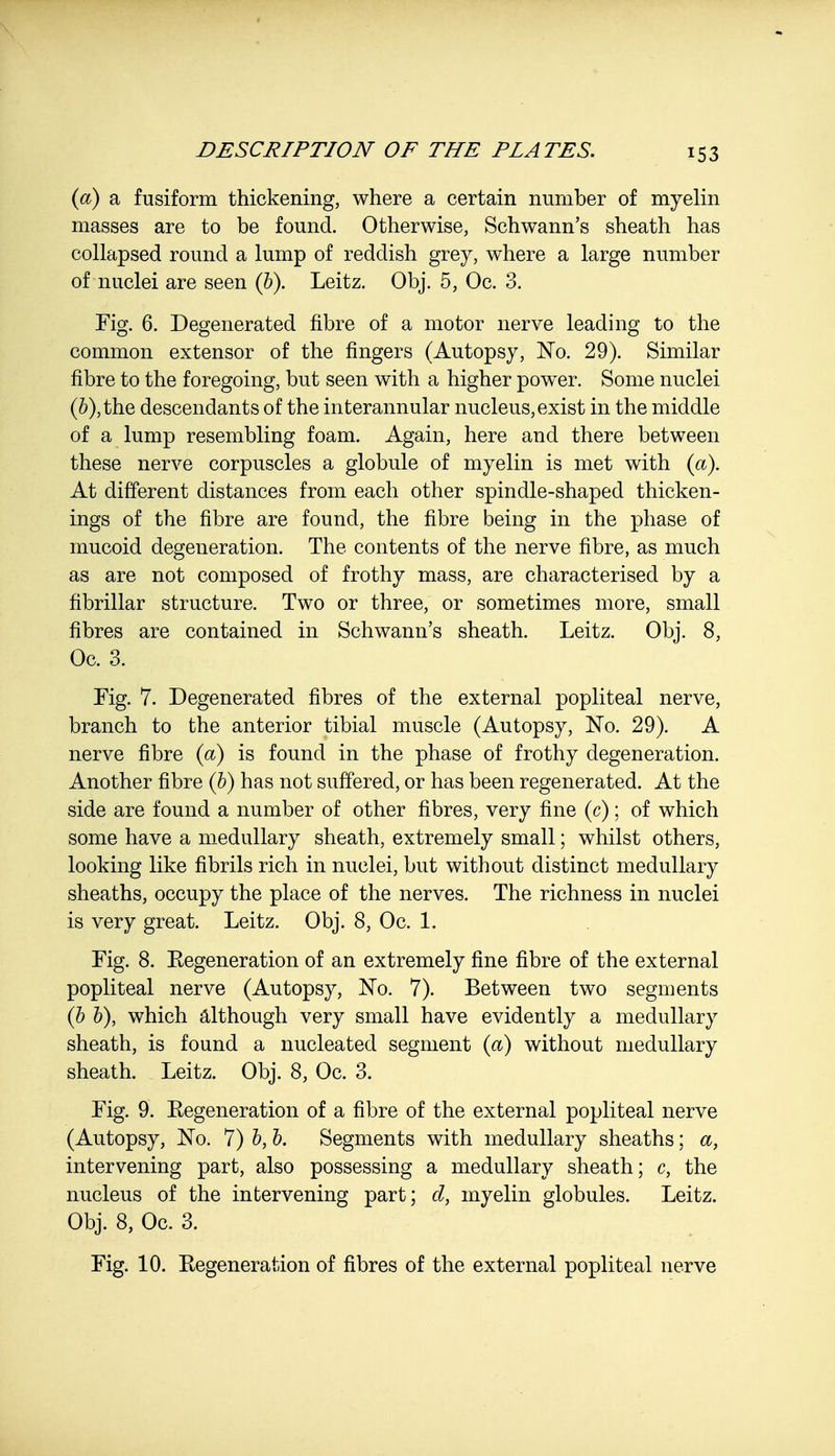 (a) a fusiform thickening, where a certain number of myelin masses are to be found. Otherwise, Schwann's sheath has collapsed round a lump of reddish grey, where a large number of nuclei are seen (b). Leitz. Obj. 5, Oc. 3. Fig. 6. Degenerated fibre of a motor nerve leading to the common extensor of the fingers (Autopsy, No. 29). Similar fibre to the foregoing, but seen with a higher power. Some nuclei (b) , the descendants of the interannular nucleus, exist in the middle of a lump resembling foam. Again, here and there between these nerve corpuscles a globule of myelin is met with (a). At different distances from each other spindle-shaped thicken- ings of the fibre are found, the fibre being in the phase of mucoid degeneration. The contents of the nerve fibre, as much as are not composed of frothy mass, are characterised by a fibrillar structure. Two or three, or sometimes more, small fibres are contained in Schwann's sheath. Leitz. Obj. 8, Oc. 3. Fig. 7. Degenerated fibres of the external popliteal nerve, branch to the anterior tibial muscle (Autopsy, No. 29). A nerve fibre (a) is found in the phase of frothy degeneration. Another fibre (b) has not suffered, or has been regenerated. At the side are found a number of other fibres, very fine (c); of which some have a medullary sheath, extremely small; whilst others, looking like fibrils rich in nuclei, but without distinct medullary sheaths, occupy the place of the nerves. The richness in nuclei is very great. Leitz. Obj. 8, Oc. 1. Fig. 8. Eegeneration of an extremely fine fibre of the external popliteal nerve (Autopsy, No. 7). Between two segments (b b), which although very small have evidently a medullary sheath, is found a nucleated segment (a) without medullary sheath. Leitz. Obj. 8, Oc. 3. Fig. 9. Eegeneration of a fibre of the external popliteal nerve (Autopsy, No. 7) b, b. Segments with medullary sheaths; a, intervening part, also possessing a medullary sheath; c, the nucleus of the intervening part; d, myelin globules. Leitz. Obj. 8, Oc. 3. Fig. 10. Eegeneration of fibres of the external popliteal nerve