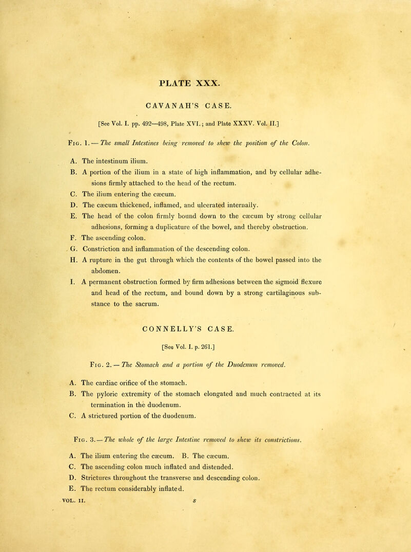 CAVANAH'S CASE. [See Vol. I. pp. 492—498, Plate XVI.; and Plate XXXV. Vol. II.] Fig. 1. — The small Intestines being removed to shew the position of the Colon. A. The intestinum ilium. B. A portion of the ilium in a state of high inflammation, and by cellular adhe- sions firmly attached to the head of the rectum. C. The ilium entering the caecum. D. The caecum thickened, inflamed, and ulcerated internally. E. The head of the colon firmly bound down to the caecum by strong cellular adhesions, forming a duplicature of the bowel, and thereby obstruction. F. The ascending colon. . G. Constriction and inflammation of the descending colon. H. A rupture in the gut through which the contents of the bowel passed into the abdomen. I. A permanent obstruction formed by firm adhesions between the sigmoid flexure and head of the rectum, and bound down by a strong cartilaginous sub- stance to the sacrum, CONNELLY'S CASE. [See Vol. I. p. 261.] Fig. 2.— The Stomach and a portion of the Duodenum removed. A. The cardiac orifice of the stomach. B. The pyloric extremity of the stomach elongated and much contracted at its termination in the duodenum. C. A strictured portion of the duodenum. Fig. 3. — The whole of the large Intestine removed to sheiv its constrictions. A. The ilium entering the caecum. B. The caecum. C. The ascending colon much inflated and distended. D. Strictures throughout the transverse and descending colon. E. The rectum considerably inflated. VOL. II. S