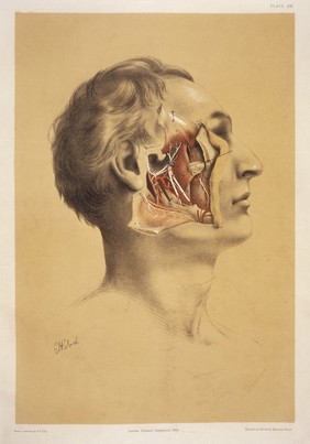 Dissection of the side of the face, with the muscles and blood vessels indicated. Colour lithograph by G.H. Ford, 1864.