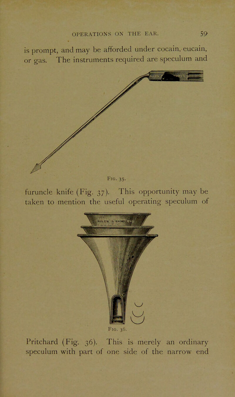 is prompt, and may be afforded under cocain, eucain, or gas. The instruments required are speculum and furuncle knife (Fig. 37). This opportunity may be taken to mention the useful operating speculum of Fig. 36. Pritchard (Fig. 36). This is merely an ordinary speculum with part of one side of the narrow end