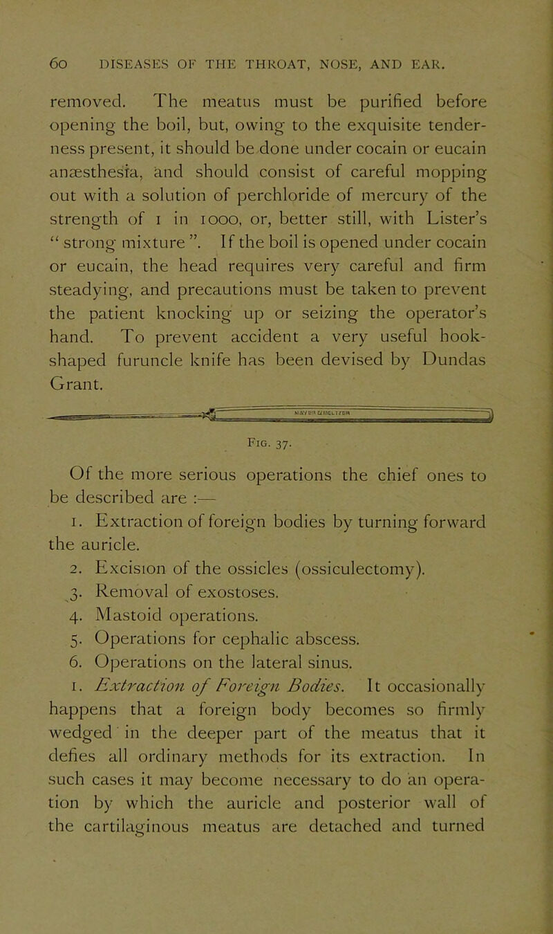 removed. The meatus must be purified before opening the boil, but, owing to the exquisite tender- ness present, it should be done under cocain or eucain anaesthesia, and should consist of careful mopping out with a solution of perchloride of mercury of the strength of i in 1000, or, better still, with Lister’s “ strong mixture ”. If the boil is opened under cocain or eucain, the head requires very careful and firm steadying, and precautions must be taken to prevent the patient knocking up or seizing the operator’s hand. To prevent accident a very useful hook- shaped furuncle knife has been devised by Dundas Grant. Fig. 37. Of the more serious operations the chief ones to be described are :— 1. Extraction of foreign bodies by turning forward the auricle. 2. Excision of the ossicles (ossiculectomy). 3. Removal of exostoses. 4. Mastoid operations. 5. Operations for cephalic abscess. 6. Operations on the lateral sinus. 1. Extraction of Foreign Bodies. It occasionally happens that a foreign body becomes so firmly wedged in the deeper part of the meatus that it defies all ordinary methods for its extraction. In such cases it may become necessary to do an opera- tion by which the auricle and posterior wall of the cartilaginous meatus are detached and turned