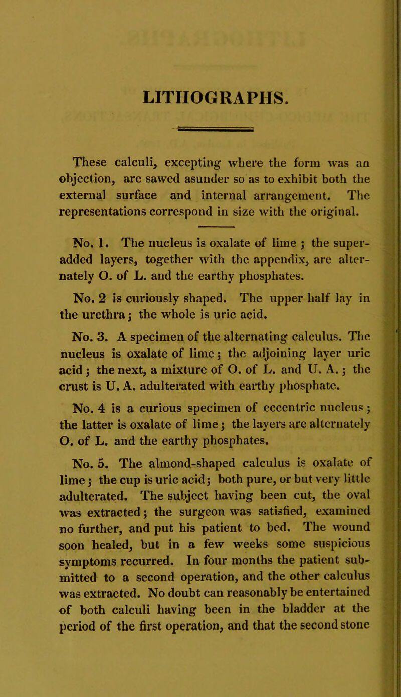 These calculi, excepting where the form was an objection, are sawed asunder so as to exhibit both the external surface and internal arrangement. The representations correspond in size with the original. No. 1. The nucleus is oxalate of lime ; the super- added layers, together with the appendix, are alter- nately O. of L. and the earthy phosphates. No. 2 is curiously shaped. The upper half lay in the urethra ; the whole is uric acid. No. 3. A specimen of the alternating calculus. The nucleus is oxalate of lime; the adjoining layer uric acid ; the next, a mixture of O. of L. and U. A.; the crust is U. A. adulterated with earthy phosphate. No. 4 is a curious specimen of eccentric nucleus; the latter is oxalate of lime; the layers are alternately O. of L. and the earthy phosphates. No. 5. The almond-shaped calculus is oxalate of lime; the cup is uric acid; both pure, or but very little adulterated. The subject having been cut, the oval was extracted; the surgeon was satisfied, examined no further, and put his patient to bed. The wound soon healed, but in a few weeks some suspicious symptoms recurred. In four months the patient sub- mitted to a second operation, and the other calculus was extracted. No doubt can reasonably be entertained of both calculi having been in the bladder at the period of the first operation, and that the second stone