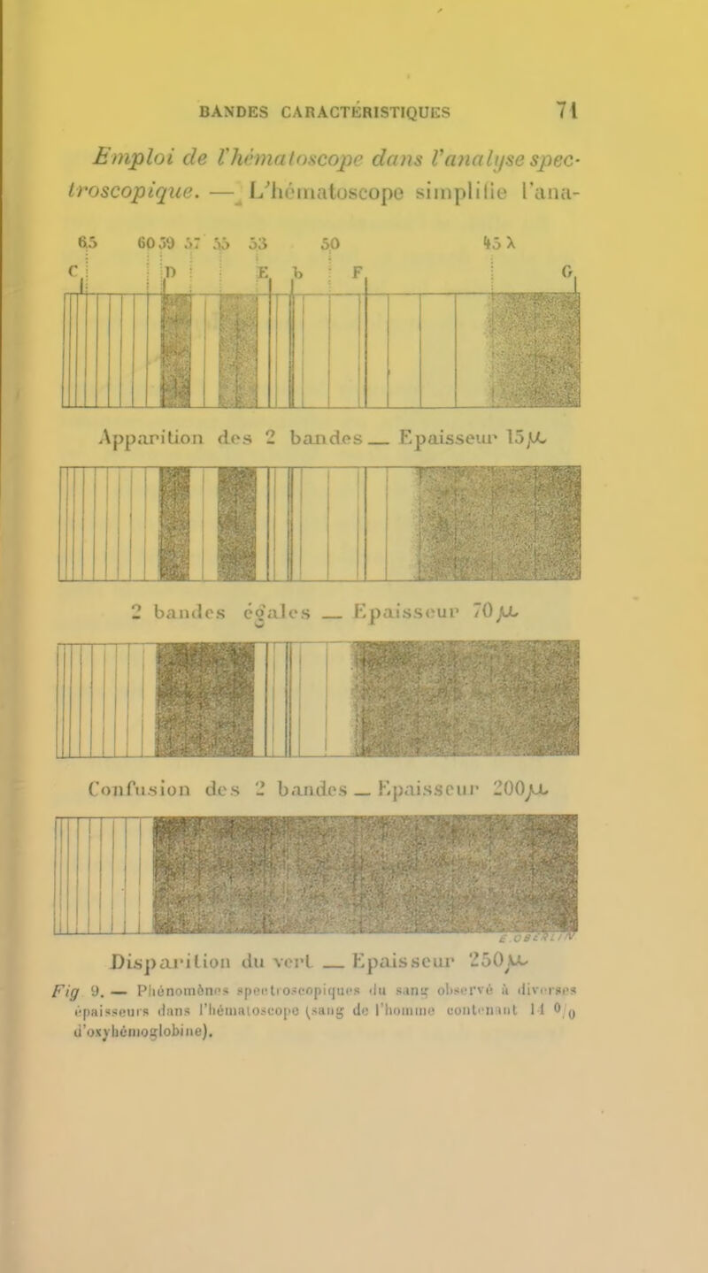 Emploi de fhSmstotcope dans Vauati/se spec- Iroscopique.—L'hrinatoscope simplilie I'ana- 65 6o;>o ;>: ;>;> 5;j 50 DE b 45 X Apparition dos 2 bandos Epaisseur 15/X, 2 bandos cgalcs Kpaissour 70jjl. Confusion des 2 b amies _ Epaisseur 200/x Disp aril ion du verl Kpaisseur 250 fig 9.— Piiiinomftni's ipeotrOJOOpi(Jue« 'In sang oliscrvu it iliv.isi's Bp&iMenri dans lliteiaitosoopo (ssng de t'homme nontenant 14 ',o li'oxyhenioglobiiie).