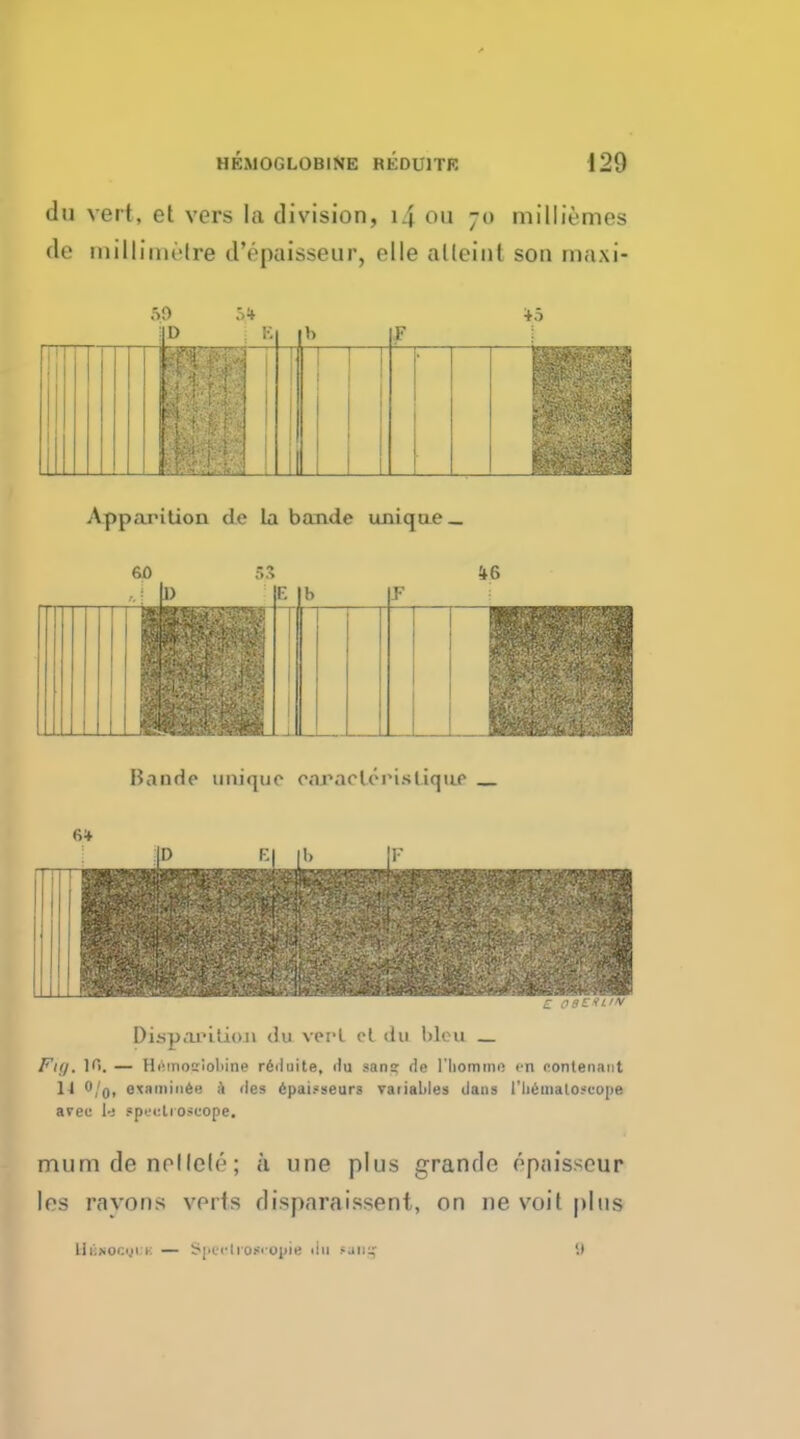 du vert, et vers la division, i.j ou 70 milliemes de milliinelre d'epaisseur, elle allcint son maxi- 59 IA io ID E h F 1 Apparition de la bande unique — E b LF L Bandc unique capacterisliou£ 1.4 Disposition du verl el du bleu _ Fig. \C>. — Hi'inoaioliine reduite, du sans de 1'liommo «'n nontenant 11 C,o, examinee a de* epaisseurs vaiialdes dans riiemalos'cope arec i-j speeli oscope. mum de nellele; a une plus grandc epaisscur les rayons verts disparaissent, on ne voit |)lus BAmmqim — SpewU'owo^is ihl .*au^ it