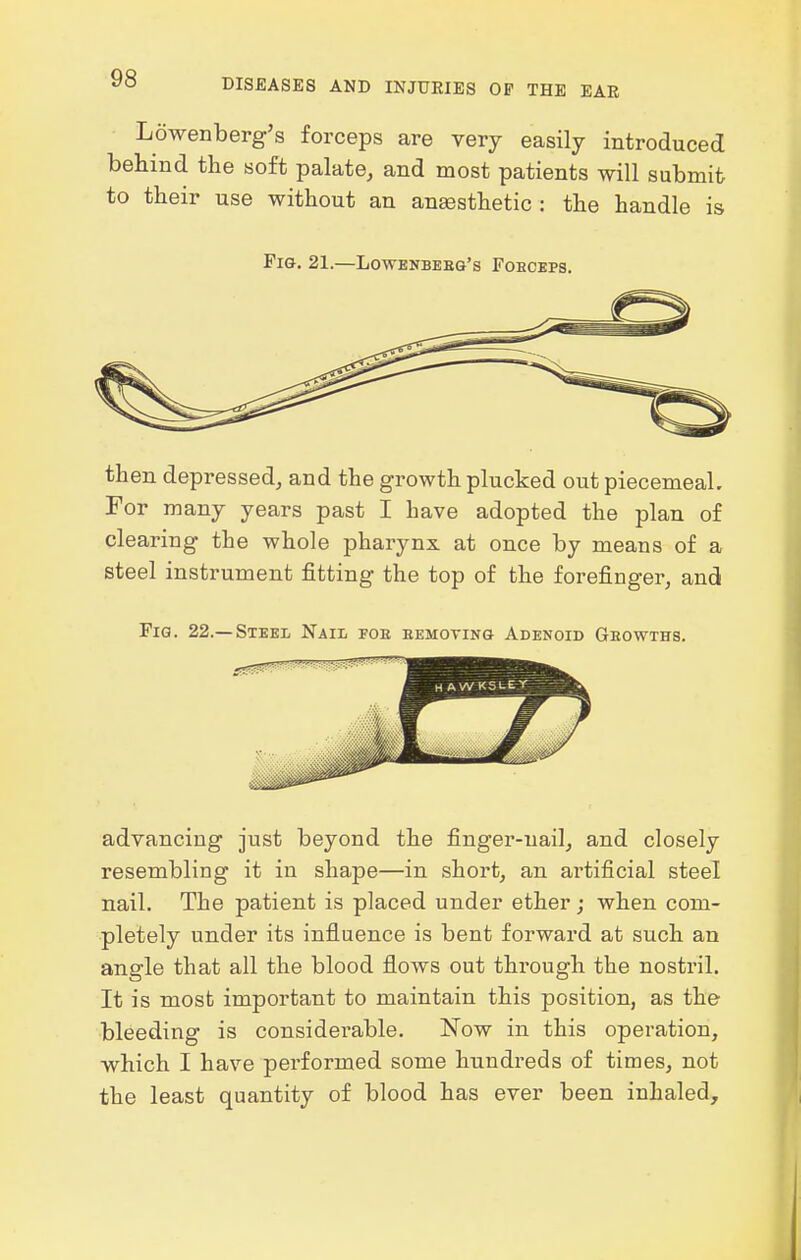 Lowenberg's forceps are very easily introduced behind the soft palate, and most patients will submit to their use without an anaBsthetic : the handle is Fig, 21.—Lowenbebq's Fobceps. then depressed, and the growth plucked out piecemeal. For many years past I have adopted the plan of clearing the whole pharynx at once by means of a steel instrument fitting the top of the forefinger, and Fig. 22.—Steel Nail foe bemoting Adenoid Geowths. advancing just beyond the finger-nail, and closely resembling it in shape—in short, an artificial steel nail. The patient is placed under ether; when com- pletely under its influence is bent forwai'd at such an angle that all the blood flows out through the nostril. It is most important to maintain this position, as the bleeding is considerable. Now in this operation, which I have performed some hundreds of times, not the least quantity of blood has ever been inhaled.