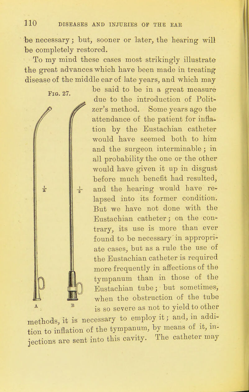 Fig. 27. be necessary; but, sooner or later, tbe hearing will be completely restored. To my mind these cases most strikingly illustrate the great advances which have been made in treating disease of the middle ear of late years, and which may be said to be in a great measure due to the introduction of Polit- zer's method. Some years ago the attendance of the patient for infla- tion by the Eustachian catheter would have seemed both to him and the surgeon interminable ; in all probability the one or the other would have given it up in disgust before much benefit had resulted, and the hearing would have re- lapsed into its former condition. But we have not done with the Eustachian catheter; on the con- trary, its use is more than ever found to be necessary in appropri- ate cases, but as a rule the use of the Eustachian catheter is required more frequently in affections of the tympanum than in those of the Eustachian tube; but sometimes, when the obstruction of the tube is so sevei-e as not to yield to other methods, it is necessary to employ it; and, in addi- tion to inflation of the tympanum, by means of it, in- jections are sent into this cavity. The catheter may