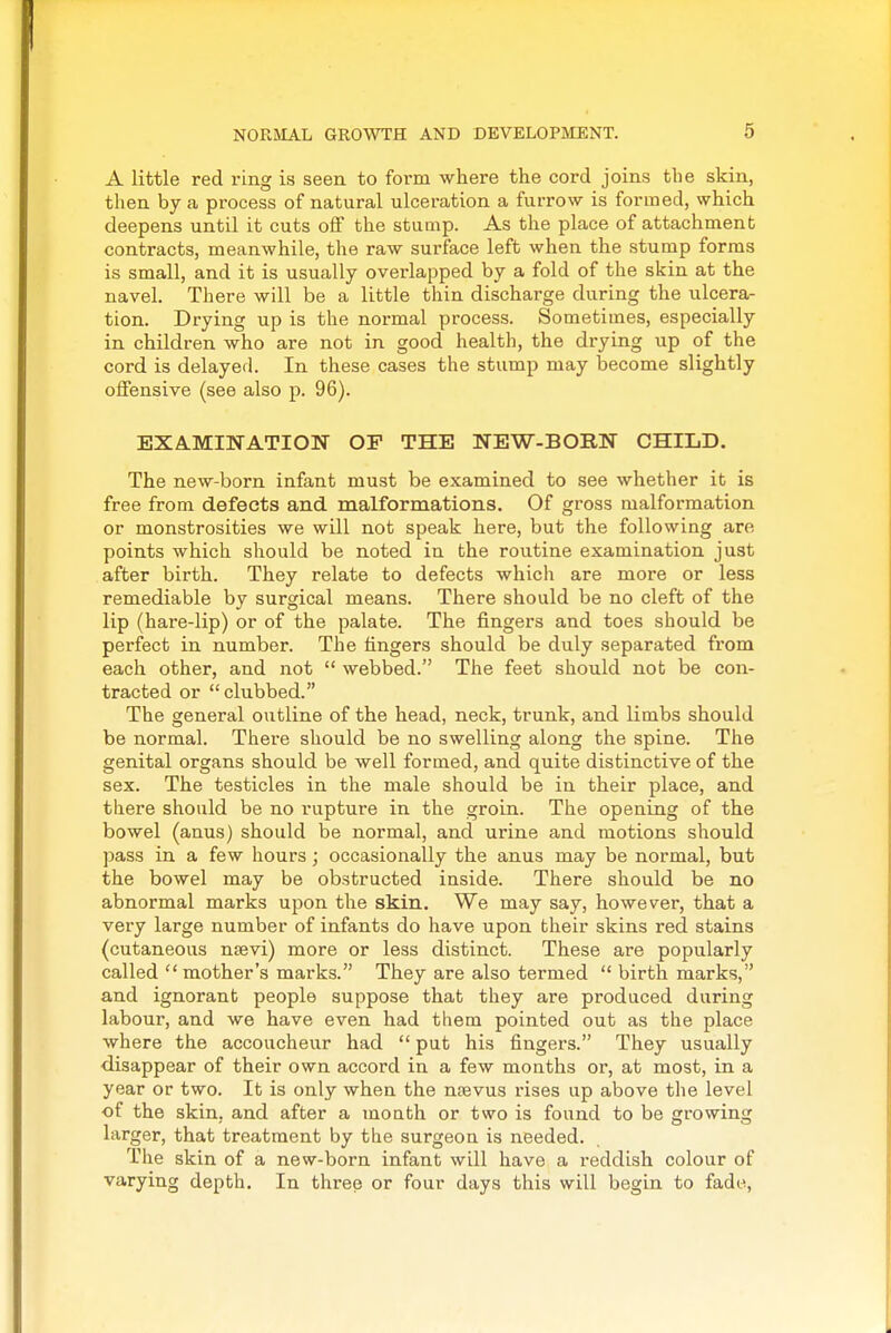 A little red ring is seen to form where the cord joins the skin, then by a process of natural ulceration a furrow is formed, which deepens until it cuts off the stump. As the place of attachment contracts, meanwhile, the raw surface left when the stump forms is small, and it is usually overlapped by a fold of the skin at the navel. There will be a little thin discharge during the ulcera- tion. Drying up is the normal process. Sometimes, especially in children who are not in good health, the drying up of the cord is delayed. In these cases the stump may iDecome slightly offensive (see also p. 96). EXAMINATION OP THE NEW-BORN CHILD. The new-born infant must be examined to see whether it is free from defects and malformations. Of gross malformation or monstrosities we will not speak here, but the following are points which should be noted in the routine examination just after birth. They relate to defects which are more or less remediable by surgical means. There should be no cleft of the lip (hare-lip) or of the palate. The fingers and toes should be perfect in number. The fingers should be duly separated from each other, and not  webbed. The feet should not be con- tracted or clubbed. The general outline of the head, neck, trunk, and limbs should be normal. There should be no swelling along the spine. The genital organs should be well formed, and quite distinctive of the sex. The testicles in the male should be in their place, and there should be no rupture in the groin. The opening of the bowel (anus) should be normal, and urine and motions should pass in a few hours; occasionally the anus may be normal, but the bowel may be obstructed inside. There should be no abnormal marks upon the skin. We may say, however, that a very large number of infants do have upon their skins red stains (cutaneous nsevi) more or less distinct. These are popularly called  mother's marks. They are also termed  birth marks, and ignorant people suppose that they are produced during labour, and we have even had them pointed out as the place where the accoucheur had  put his fingers. They usually disappear of their own accord in a few months or, at most, in a year or two. It is only when the nsevus rises up above the level of the skin, and after a mouth or two is found to be growing larger, that treatment by the surgeon is needed. The skin of a new-born infant will have a reddish colour of varying depth. In three or four days this will begin to fade,