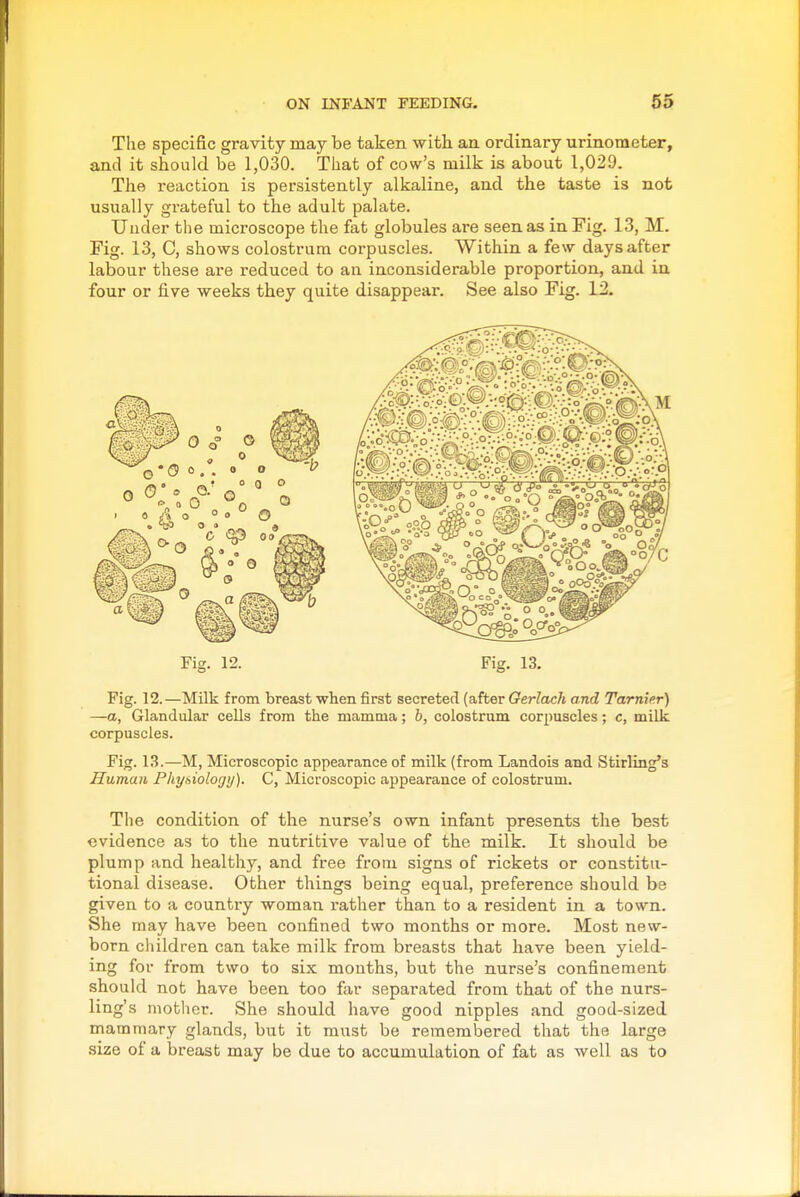 The specific gravity may be taken with an. ordinary urinometer, and it should be 1,030. That of cow's milk is about 1,029. The reaction is persistently alkaline, and the taste is not usually gi'ateful to the adult palate. Under the microscope the fat globules are seen as in Fig. 13, M. Fig. 13, C, shows colostrum corpuscles. Within a few days after labour these are reduced to an inconsiderable proportion, and in four or five weeks they quite disappear. See also Fig. 12. Fig. 12. Fig. 13, Fig. 12.—Milk from breast when first secreted (after Gerlach and Tarnier) —a. Glandular cells from the mamma; b, colostrum corpuscles; c, milk corpuscles. Fig. 13.—M, Microscopic appearance of milk (from Landois and Stirling's Human Phy&iology). C, Microscopic appearance of colostrum. The condition of the nurse's own infant presents the best evidence as to the nutritive value of the milk. It should be plump and healthy, and free from signs of rickets or constitu- tional disease. Other things being equal, preference should be given to a country woman rather than to a resident in a town. She may have been confined two months or more. Most new- born children can take milk from breasts that have been yield- ing for from two to six mouths, but the nurse's confinement should not have been too far separated from that of the nurs- ling's mother. She should have good nipples and good-sized mammary glands, but it must be rememljered that the large size of a breast may be due to accumulation of fat as well as to