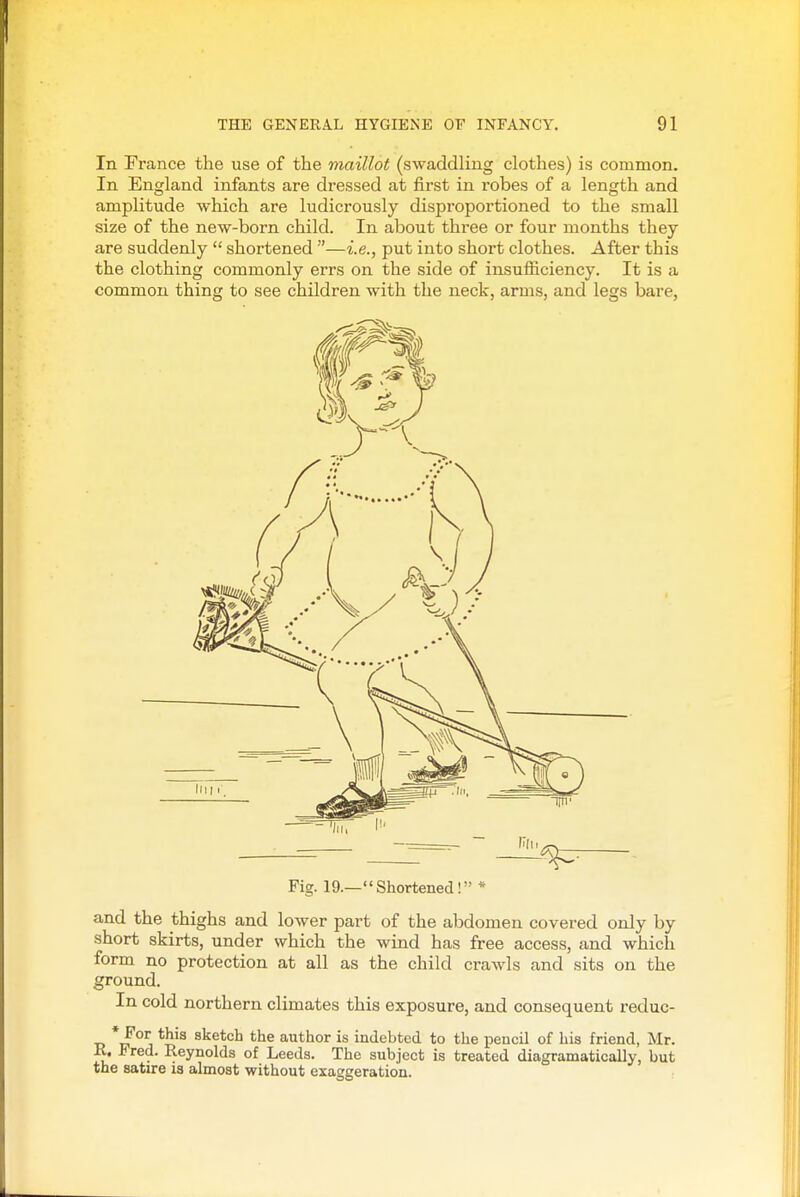 In France the use of the maillot (swaddling clothes) is common. In England infants are dressed at first in robes of a length and amplitude which are ludicrously disproportioned to the small size of the new-born child. In about three or four months they are suddenly  shortened —i.e., put into short clothes. After this the clothing commonly errs on the side of insufiiciency. It is a common thing to see children with the neck, arms, and legs bare, Fig. 19.—Shortened! * and the thighs and lower part of the abdomen covered only by short skirts, under which the wind has free access, and which form no protection at all as the child crawls and sits on the ground. In cold northern climates this exposure, and consequent reduc- T? sketch the author is indebted to the pencil of his friend, Mr. K. i red. Reynolds of Leeds. The subject is treated diagramatically, but the satire is almost without exaggeration.