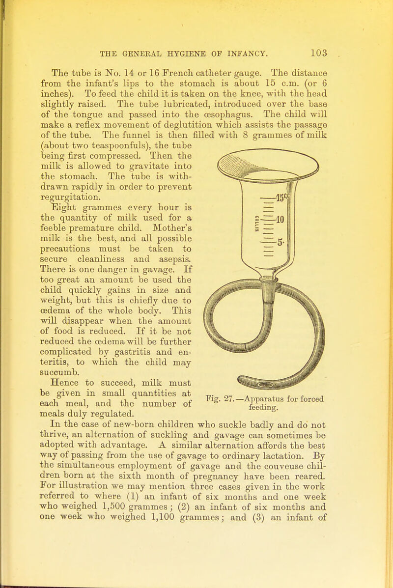 The tube is No. 14 or 16 French catheter gauge. The distance from the infant's lips to the stomach is about 15 cm. (or 6 inches). To feed the child it is taken on the knee, with the head slightly raised. The tube lubricated, introduced over the base of the tongue and passed into the oesophagus. The child will make a reflex movement of deglutition which assists the passage of the tube. The funnel is then filled with S grammes of milk (about two teaspoonfuls), the tube being first compressed. Then the milk is allowed to gravitate into the stomach. The tube is with- drawn rapidly in order to prevent regurgitation. Eight grammes every hour is the quantity of milk used for a feeble premature child. Mother's milk is the best, and all possible precautions must be taken to secure cleanliness and asepsis. There is one danger in gavage. If too great an amount be used the child quickly gains in size and weight, but this is chiefly due to oedema of the whole body. This will disappear when the amount of food is reduced. If it be not reduced the oedema will be further complicated by gastritis and en- teritis, to which the child may succumb. Hence to succeed, milk must be given in small quantities at each meal, and the number of meals duly regulated. In the case of new-born children who suckle badly and do not thrive, an alternation of suckling and gavage can sometimes be adopted with advantage. A similar alternation afibrds the best way of passing from the use of gavage to ordinary lactation. By the simultaneous employment of gavage and the couveuse chil- dren born at the sixth month of pregnancy have been reared. For illustration we may mention three cases given in the work referred to where (1) an infant of six months and one week who weighed 1,500 grammes; (2) an infant of six months and one week who weighed 1,100 grammes; and (3) an infant of Fig. 27. —Apparatus for forced feeding.