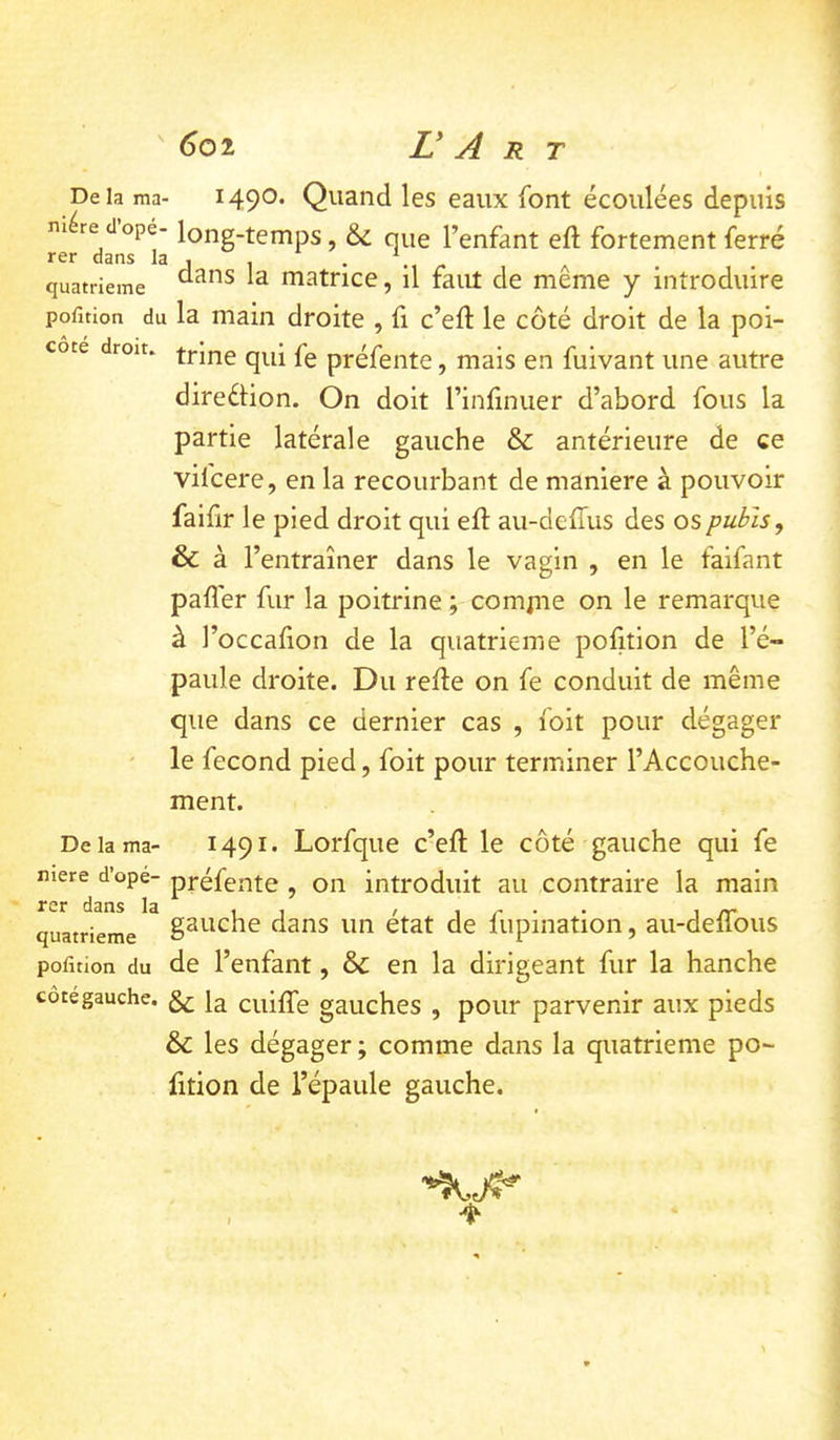  ^02 L* A R T Delà ma- 1490. Quand les eaux font écoulées depuis niére dopé- long-temps, & nue l’enfant eft fortement ferré rer dans la , , . ^ quatrième matrice, il faut de meme y introduire pofuion du la main droite , fi c’eft le côté droit de la poi- cote droit. -fj-Jne pg préfente, mais en fuivant une autre direéHon. On doit l’infinuer d’abord fous la partie latérale gauche & antérieure de ce vifcere, en la recourbant de maniéré à pouvoir faifir le pied droit qui eft au-deffus des os pubis ^ & à r 'entraîner dans le vagin , en le falfant pafl'er fur la poitrine ; comjne on le remarque à l’occalion de la quatrième pofition de l’é- paule droite. Du relie on fe conduit de même que dans ce dernier cas , foit pour dégager le fécond pied, foit pour terminer l’Accouche- ment. De la ma- 1491. Lorfque c’ell le côté gauche qui fe mere d’ope- préfente , Oïl introduit au contraire la main 2*cr dsris quatrième dans un état de fupination, au-delTous pofition du de l’enfant, & en la dirigeant fur la hanche cotegauche. cuilTe gauches , pour parvenir aux pieds & les dégager ; comme dans la quatrième po~ lition de l’épaule gauche.