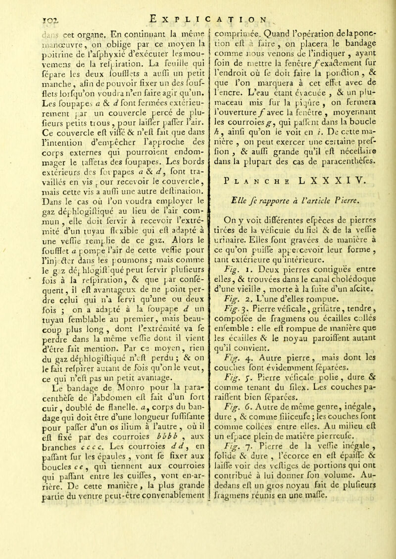 . ; cet organe. En continuant la même manœuvre, on oblige par ce moyen la poitrine de l'afphyxié d'exécuter lesmou- vemens de la relpiration. La feuille qui fépare les deux loufflets a auffi un petit manche , afin de pouvoir fixer un des louf- flets lorfqu'on voudra n'en faire agir qu'un. Les foupape^ a & d font fermées extérieu- rement jjr un couvercle percé de plu- fieurs petits trous, pour lailTer paiïèr l'air. Ce couvercle eft viffé & n'eft fait que dans l'intention d'empêcher l'approche des corps externes qui pourroient endom- mager le taffetas des foupapes. Les bords extérieurs des foi papes a & d, font tra- vaillés en vis rour recevoir le couvercle, mais cette vis a auffi une autre deftination. Dans le cas où l'on voudra employer le gaz déphlogiftiqué au lieu de l'air com- mun , elle doit fervir à recevoir l'extré- mité d'un tuyau flexible qui eft adapté à une vellie remplie de ce gaz. Alors le foufïïet a pompe l'air de cette veflie pour Fini der dans les poumons; mais comme le gaz dé|hlôgifi:quépeut fervir plufieurs fois à la relpiration, & que par confé- quent, il eft avantageux de ne point per- dre celui qui n'a fervi qu'une ou deux fois ; on a adapté à la foupape d un tuyau femblable au premier, mais beau- coup plus long , dont l'extrémité va fe perdre dans la même veille dont il vient d'être fait mention. Par ce moyen, rien du gaz déphlogiftiqué n'eft perdu; & on le fait relpirer autant de fois qu'on le veut, ce qui n'eft pas un petit avantage. Le bandage de IVIonro pour la para- centhèfe de l'abdomen eft fait d'un fort cuir, doublé de flanelle, a, corps du ban- dage qui doit être d'une longueur fuflifante pour pafler d'un os ilium à l'autre , où il eft fixé par des courroies bbbb , aux branches ce ce. Les courroies dd, en palfant fur les épaules , vont fe fixer aux boucles ce, qui tiennent aux courroies qui paflant entre les cuiffes, vont en-ar- rière. De cette manière , la plus grande partie du ventre peut-être convenablement compriuiée. Quand l'opération de la ponc- tion eft à faire , on placera le bandage comme nous venons de l'indiquer , ayant foin de mettre la fenêtre/'exactement fur l'endroit où fe doit faire la ponction , 6c que l'on marquera à cet effet avec de l'encre. L'eau étant évacuée , & un plu- maceau mis fur la piqûre , on fermera l'ouverture /avec la fenêtre , moyennant les courroies^, qui paffent dans la boucle ainfi qu'on le voit en i. De cette ma- nière , oji peut exercer une certaine pref- fion , & auffi grande qu'il eft néceliaire dans la plupart des cas de paracenthèfes. Planche LXXXIV. Elle fe rapporte à Varticle Pierre. On y voit différentes efpèces de pierres tirées de la véficuie du fiel & de la veflie urinaire. Elles font gravées de manière à ce qu'on puilfe appercevoir leur forme , tant extérieure qu'intérieure. Fig. i. Deux pierres contigu'ës entre elles, & trouvées dans le canal cholédoque d'une vieille , morte à la fuite d'un afeite. Fig. 2. L'une d'elles rompue. Fig, 3. Pierre véficale, grifàtre, tendre, compolée de fragmens ou écailles collés enlemble : elle eft rompue de manière que les écailles cv le noyau paroiflent autant qu'il convient. Fig. 4. Autre pierre, mais dont les couches font évidemment féparées. Fig. 5. Pierre véficale polie, dure Se comme tenant du filex. Les couches pa- raiflent bien féparées. Fig. 6. Autre de même genre, inégale, dure , & comme filiceufe; les couches font comme collées entre elles. Au milieu eft un efpace plein de matière pierreufe. Fig. 7. Pierre de la veffie inégale , folide & dure , l'écorce en eft épaifte & lailfe voir des veftiges de portions qui ont contribué à lui donner fon volume. Au- dedans eft un gros noyau fait de plufieurs fragmens réunis en une malfe.