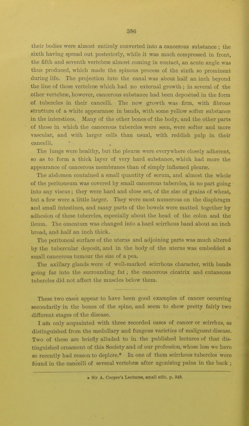 their bodies were almost entirely converted into a cancerous substance ; the sixth having spread out posteriorly, while it was much compressed in front, the fifth and seventh vertebrje almost coming in contact, an acute angle was thus produced, which made the siDinous process of the sixth so prominent during life. The projection into the canal was about half an inch beyond the line of those vertebrae which had no external growth ; in several of the other vertebra, however, cancerous substance had been deposited in the form of tubercles in their cancelli. The new growth was firm, with fibrous structure of a white appearance in bands, with some yellow softer substance in the interstices. Many of the other bones of the body, and the other parts of those in which the cancerous tubercles were seen, were softer and more vascular, and with larger cells than usual, with reddish puljj in their cancelli. The lungs were healthy, but the pleurae were everywhere closely adherent, so as to form a thick layer of very hard substance, which had more the appearance of cancerous membranes than of simply inflamed pleurje. The abdomen contained a small quantity of serum, and almost the whole of the peritoneum was covered by small cancerous tubercles, in no part going into any viscus ; they were hard and close set, of the size of grains of wheat, but a few were a little larger. They were most numerous on the diaphragm and small intestines, and many parts of the bowels were matted together by adhesion of these tubercles, especially about the head of the colon and the ileum. The omentum was changed into a hard scirrhous band about an inch broad, and half an inch thick. The peritoneal surface of the uterus and adjoining parts was much altered by the tubercular deposit, and in the body of the uterus was embedded a small cancerous tumour the size of a pea. The axillary glands were of well-marked scirrhous character, -with bands going far into the surrounding fat; the cancerous cicatiix and cutaneous tubercles did not affect the muscles below them. These two cases appear to have been good examples of cancer occurring secondarily in the bones of the spine, and seem to show pretty fairly two different stages of the disease. I am only acquainted with three recorded cases of cancer or scirrhus, as distinguished from the medullary and fungous varieties of malignant disease. Two of these are briefly alluded to in the published lectures of that dis- tinguished ornament of this Society and of our profession, whose loss we have so recently had reason to deplore.* In one of them scirrhous tubercles were found in the cancelli of several vertebrae after agonizing pains in the back ; ♦ Sir A. Cooper's Lectures, small edit. p. 349.