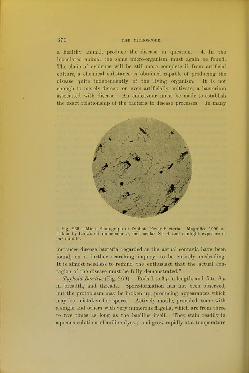 a healthy animal, produce the disease in question. 4. In the inoculated animal the same micro-organism must again be found. The chain of evidence will be still more complete if, from artificial culture, a chemical substance is obtained capable of producing the disease quite independently of the living organism. It is not enough to merely detect, or even artificially cultivate, a bacterium associated with disease. An endeavour must be made to establish the exact relationship of the bacteria to disease processes. In many Fig. 269.—Micro-Photograph ot Typhoid Fever Bacteria. Magnified 1000 x. Taken by Leilz's oil immersion ^^^i^^! ocular No. 4, and sunlight exposure of one minute. instances disease bacteria regarded as the actual contagia have been found, on a further searching inquiry, to be entii'ely misleading. It is almost needless to remind the enthusiast that the actual con- tagion of the disease must be fully demonstrated. Typhoid Bacillus (Fig. 269).—Eods 1 to 3 //.in length, and 5 to 'S /i in breadth, and threads. Spore-formation has not been observed, but the protoplasm may be broken up, producing appeai'ances which may be mistaken for spores. Actively motile, provided, some with a single and others with very numerous flagella, which are from three to five times as long as the bacillus itself. They stain readily in aqueous solutions of aniline dyes ; and grow rapidly at a temperature