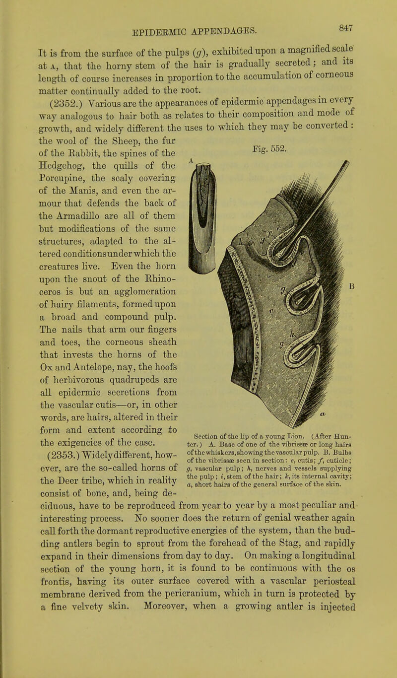 EPIDERMIC APPENDAGES. It is from the sur face of the pulps (g), exhibited upon a magnified scale at A, that the horny stem of the hair is gradually secreted; and its length of course increases in proportion to the accumulation of corneous matter continually added to the root. (2352.) Various are the appearances of epidermic appendages in every way analogous to hair both as relates to their composition and mode of growth, and widely different the uses to which they may be converted : the wool of the Sheep, the fur of the Eabbit, the spines of the -^^S- 552. Hedgehog, the quills of the Porcupine, the scaly covering of the Manis, and even the ar- mour that defends the back of the Armadillo are all of them but modifications of the same structures, adapted to the al- tered conditions under which the creatures live. Even the horn upon the snout of the Ehino- ceros is but an agglomeration of hairy filaments, formed upon a broad and compound pulp. The nails that arm our fiLagers and toes, the corneous sheath that invests the horns of the Ox and Antelope, nay, the hoofs of herbivorous quadrupeds are all epidermic secretions from the vascular cutis—or, in other words, are hairs, altered in their form and extent according to the exigencies of the case. (2353.) Widelydifferent, how- ever, are the so-called horns of the Deer tribe, which in reality consist of bone, and, being de- ciduous, have to be reproduced from year to year by a most peculiar and interesting process. No sooner does the return of genial weather again call forth the dormant reproductive energies of the system, than the bud- ding antlers begin to sprout from the forehead of the Stag, and rapidly expand in their dimensions from day to day. On making a longitudinal section of the young horn, it is found to be continuous with the os frontis, having its outer surface covered with a vascular periosteal membrane derived from the pericranium, which in turn is protected by a fine velvety skin. Moreover, when a growing antler is injected Section of the lip of a young Lion. (After Hun- ter. ) A. Base of one of the vibrissee or long hairs ofthewhiskerSjShowingthevasoularpulp. B. Bulbs of the vibrissee seen in section: e, cutis; J, cuticle; g, vascular pulp; h, nerves and vessels supplying the pulp; i, stem of the hair; k, its internal cavity; a, short hairs of the general surface of the skin.