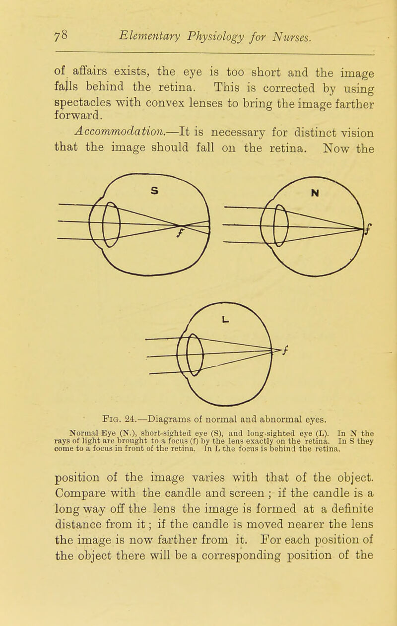 of affairs exists, the eye is too short and the image falls behind the retina. This is corrected by using spectacles with convex lenses to bring the image farther forward. Accommodation.—It is necessary for distinct vision that the image should fall on the retina. Now the Fig. 24.—Diagrams of normal and abnormal eyes. Normal Eye (N.), short-sighted eye (S), and long-sighted eye (L). In N the rays of light are brought to a focus (f) by the lens exactly on the retina. In S they come to a focus in front of the retina. In L the focus is behind the retina. position of the image varies with that of the object. Compare with the candle and screen ; if the candle is a long way off the lens the image is formed at a definite distance from it; if the candle is moved nearer the lens the image is now farther from it. For each position of the object there will be a corresponding position of the