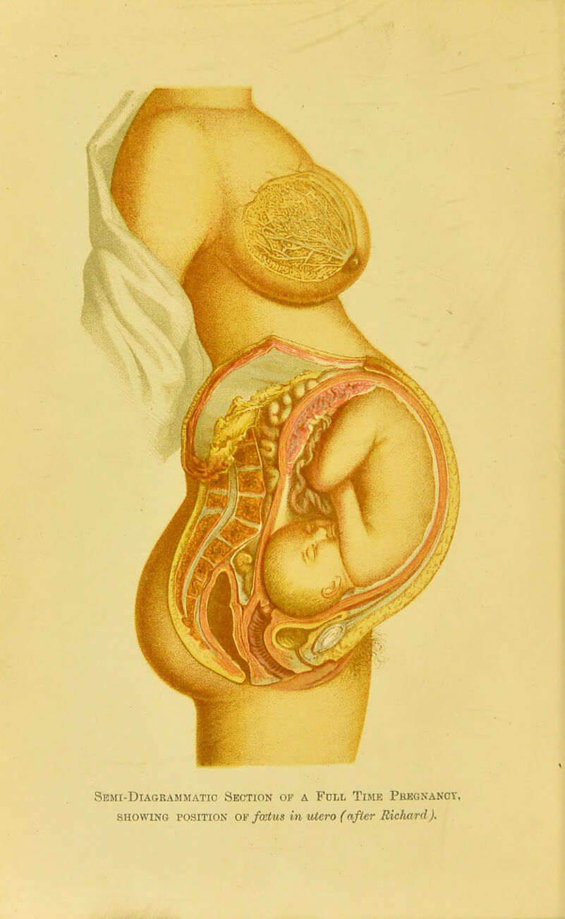 Semi-Diagrammatic Section of a Full Time Pregnancy, showing 15osition of foetus in utcro (after Rwhard).