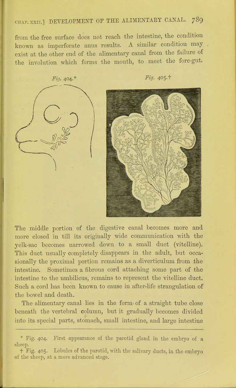 from the free surface does not reach the intestine, the condition known as imperforate anus results. A similar condition may exist at the other end of the alimentary canal from the failure of the involution which forms the mouth, to meet the fore-gut. Fig. 404.* Fig- 405- + The middle portion of the digestive canal becomes more and more closed in till its originally wide communication with the yelk-sac becomes narrowed down to a small duct (vitelline). This duct usually completely disappears in the adult, but occa- sionally the proximal portion remains as a diverticulum from the intestine. Sometimes a fibrous cord attaching some part of the intestine to the umbihcus, remains to represent the vitelline duct. Such a cord has been known to cause in after-life strangulation of the bowel and death. The alimentary canal lies in the form- of a straight tube close beneath the vertebral column, but it gradually becomes divided into its special parts, stomach, small intestine, and large intestine * Fig. 404. First appearance of the parotid gland in tlie embrj'o of a .slieep. t Fig. 405. Lobules of the parotid, with the salivary ducts, in the embryo of the sheep, at a more advanced stage.