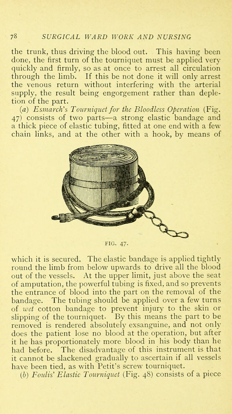 the trunk, thus driving the blood out. This having been done, the iirst turn of the tourniquet must be appHed verv quickly and firmly, so as at once to arrest all circulation through the limb. If this be not done it will only arrest the venous return without interfering with the arterial supply, the result being engorgement rather than deple- tion of the part. (a) Esnmrch's Tourniquet for the Bloodless Operation (Fig. 47) consists of two parts—a strong elastic bandage and a thick piece of elastic tubing, fitted at one end with a few chain links, and at the other with a hook, by means of which it is secured. The elastic bandage is applied tightly round the limb from below upwards to drive all the blood out of the vessels. At the upper limit, just above the seat of amputation, the powerful tubing is fixed, and so prevents the entrance of blood into the part on the removal of the bandage. The tubing should be applied over a few turns of wet cotton bandage to prevent injury to the skin or slipping of the tourniquet- By this means the part to be removed is rendered absolutely exsanguine, and not only does the patient lose no blood at the operation, but after it he has proportionately more blood in his body than he had before. The disadvantage of this instrument is that it cannot be slackened gradually to ascertain if all vessels have been tied, as with Petit's screw tourniquet. {b) Fonlis' Elastic Tourniquet (Fig. 48) consists of a piece