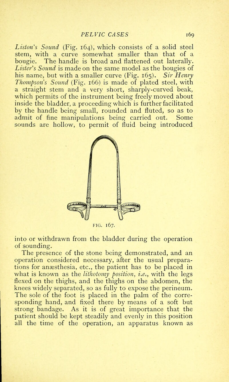 Liston's Sound (Fig. 164), which consists of a solid steel stem, with a curve somewhat smaller than that of a bougie. The handle is broad and flattened out laterally. Lister's Sound is made on the same model as the bougies of his name, but with a smaller curve (Fig. 165). Sir Henry Thompson's Sound (Fig. 166) is made of plated steel, with a straight stem and a very short, sharply-curved beak, which permits of the instrument being freely moved about inside the bladder, a proceeding which is further facilitated by the handle being small, rounded and fluted, so as to admit of fine manipulations being carried out. Some sounds are hollow, to permit of fluid being introduced FIG. 167. into or withdrawn from the bladder during the operation of sounding. The presence of the stone being demonstrated, and an operation considered necessary, after the usual prepara- tions for anaesthesia, etc., the patient has to be placed in what is known as the lithotomy position, i-.e-., with the legs flexed on the thighs, and the thighs on the abdomen, the knees widely separated, so as fully to expose the perineum. The sole of the foot is placed in the palm of the corre- sponding hand, and fixed there by means of a soft but strong bandage. As it is of great importance that the patient should be kept steadily and evenly in this position all the time of the operation, an apparatus known as