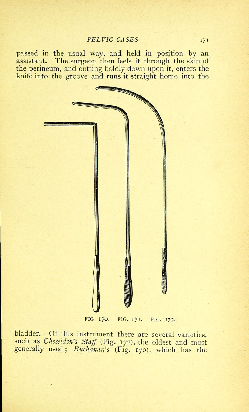 passed in the usual way, and held in position by an assistant. The surgeon then feels it through the skin of the perineum, and cutting boldly down upon it, enters the knife into the groove and runs it straight home into the FIG 170. FIG. 171. FIG. 172. bladder. Of this instrument there are several varieties, such as Cheselden's Staff (Fig. 172), the oldest and most generally used; Buchanan's (Fig. 170), which has the