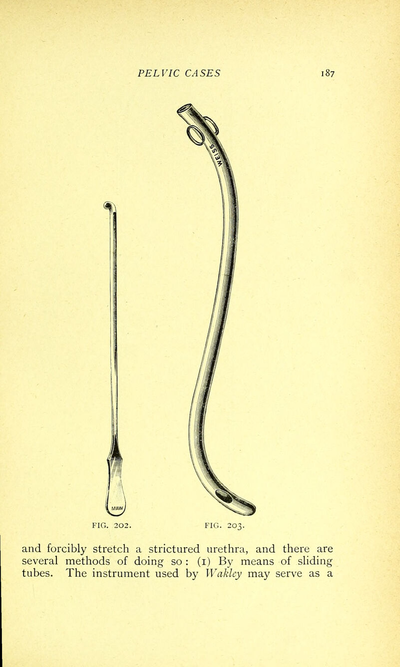 FIG. 202. FIG. 203. and forcibly stretch a strictured urethra, and there are several methods of doing so : (i) By means of sliding tubes. The instrument used by Wakley may serve as a