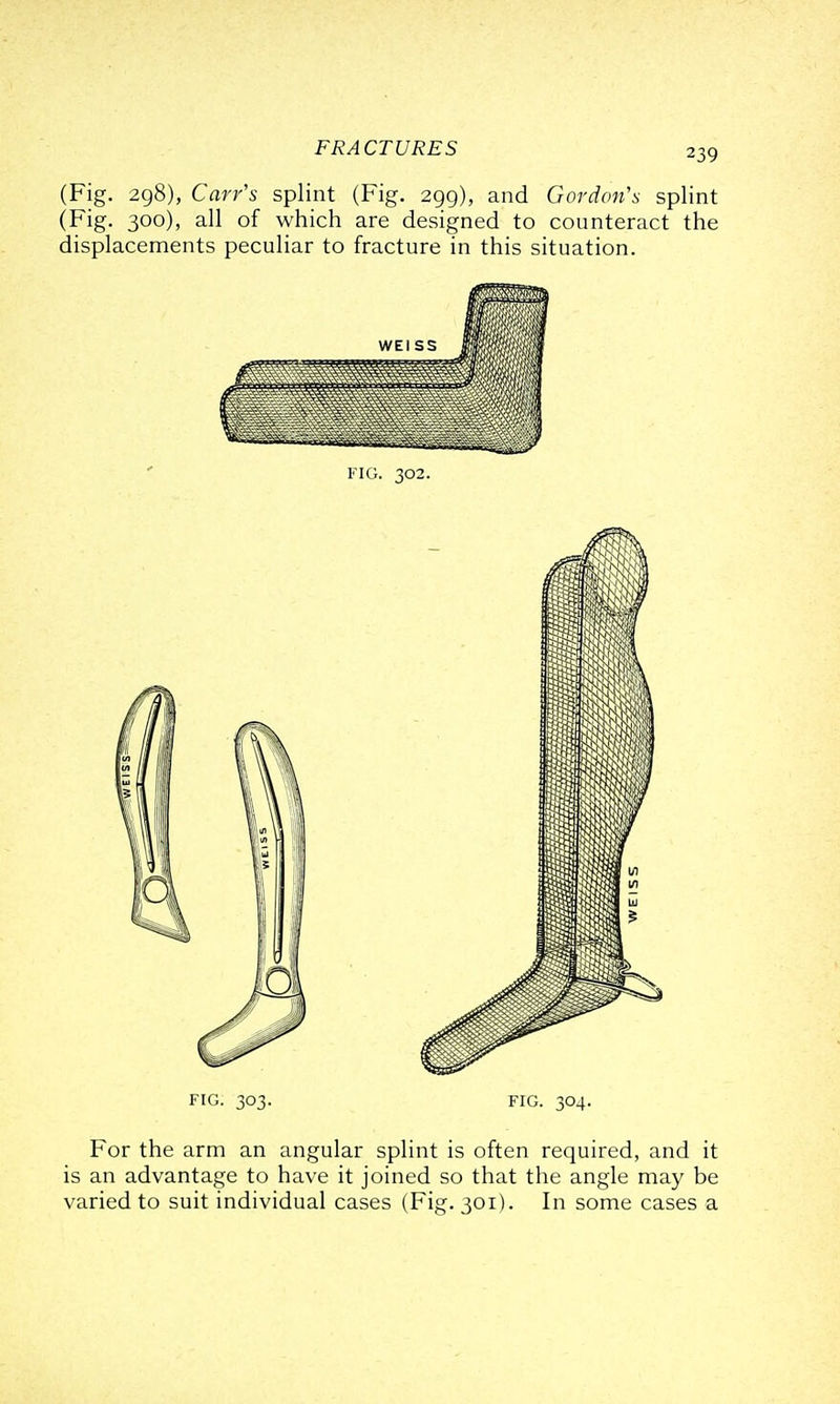 (Fig. 298), Car/s splint (Fig. 299), and Gordon's splint (Fig. 300), all of which are designed to counteract the displacements peculiar to fracture in this situation. FIG. 303. FIG. 304. For the arm an angular splint is often required, and it is an advantage to have it joined so that the angle may be varied to suit individual cases (Fig. 301). In some cases a