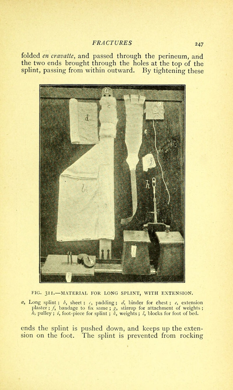 folded en cravatte, and passed through the perineum, and the two ends brought through the holes at the top of the splint, passing from within outward. By tightening these FIG. 311.—MATERIAL FOR LONG SPLINT, WITH EXTENSION. a. Long splint ; sheet : r, padding; d, binder for chest ; e, extension plaster; /', bandage to fix same ; stirrup for attachment of weights ; h, pulley; i, foot-piece for splint ; k, weights; /, blocks for foot of bed. ends the splint is pushed down, and keeps up the exten- sion on the foot. The splint is prevented from rocking