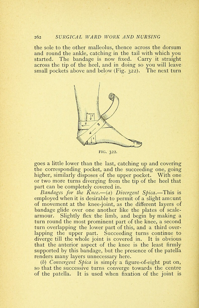 the sole to the other malleolus, thence across the dorsum and round the ankle, catching in the tail with which you started. The bandage is now fixed. Carry it straight across the tip of the heel, and in doing so you will leave small pockets above and below (Fig. 322). The next turn goes a little lower than the last, catching up and covering the corresponding pocket, and the succeeding one, going higher, similarly disposes of the upper pocket. With one or two more turns diverging from the tip of the heel that part can be completely covered in. Bandages for the Knee.—(a) Divergent Spica.—This is employed when it is desirable to permit of a slight amount of movement at the knee-joint, as the different layers of bandage glide over one another like the plates of scale- armour. Slightly flex the limb, and begin by making a turn round the most prominent part of the knee, a second turn overlapping the lower part of this, and a third over- lapping the upper part. Succeeding turns continue to diverge till the whole joint is covered in. It is obvious that the anterior aspect of the knee is the least firmly supported by this bandage, but the presence of the patella renders many layers unnecessary here. (b) Convergent Spica is simply a figure-of-eight put on, so that the successive turns converge towards the centre of the patella. It is used when fixation of the joint is