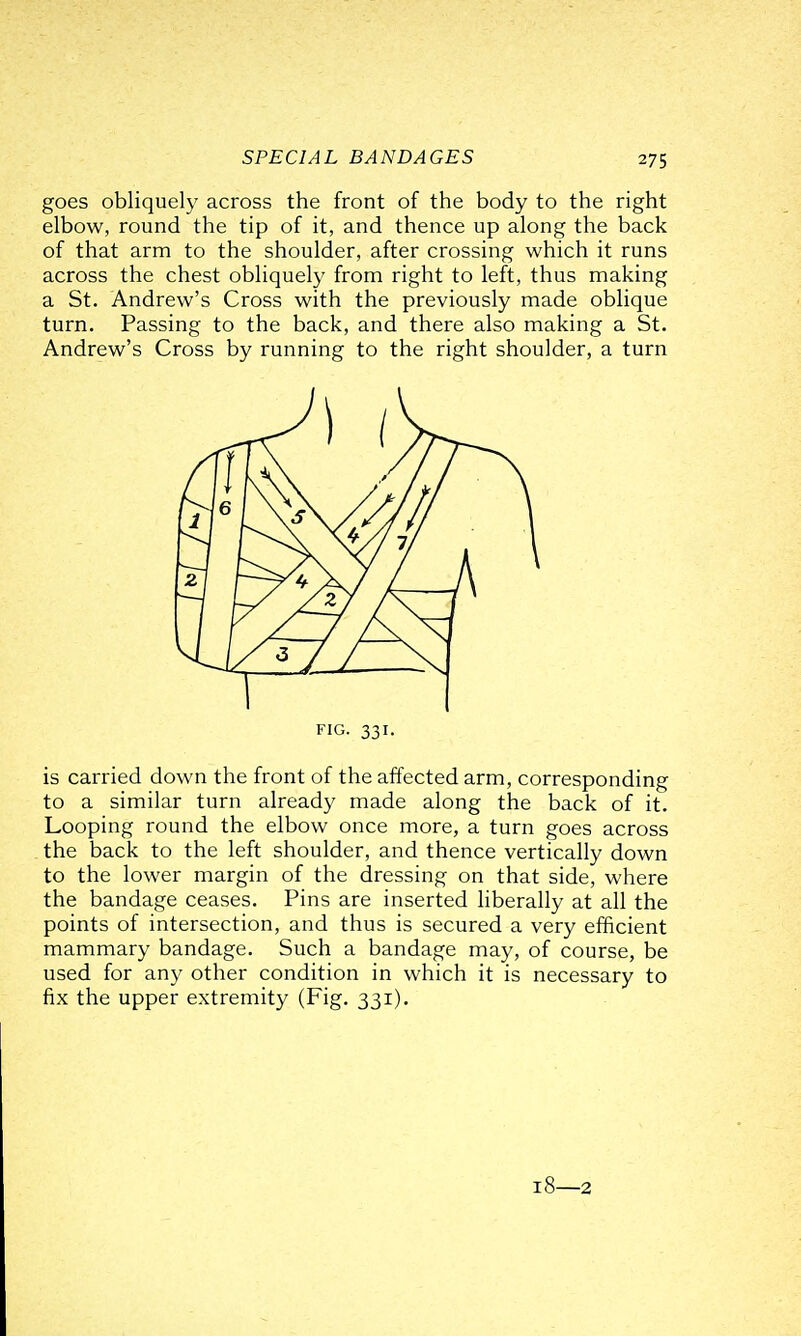 goes obliquely across the front of the body to the right elbow, round the tip of it, and thence up along the back of that arm to the shoulder, after crossing which it runs across the chest obliquely from right to left, thus making a St. Andrew's Cross with the previously made oblique turn. Passing to the back, and there also making a St. Andrew's Cross by running to the right shoulder, a turn FIG. 331. is carried down the front of the affected arm, corresponding to a similar turn already made along the back of it. Looping round the elbow once more, a turn goes across the back to the left shoulder, and thence vertically down to the lower margin of the dressing on that side, where the bandage ceases. Pins are inserted hberally at all the points of intersection, and thus is secured a very efficient mammary bandage. Such a bandage may, of course, be used for any other condition in which it is necessary to fix the upper extremity (Fig. 331). 18—2