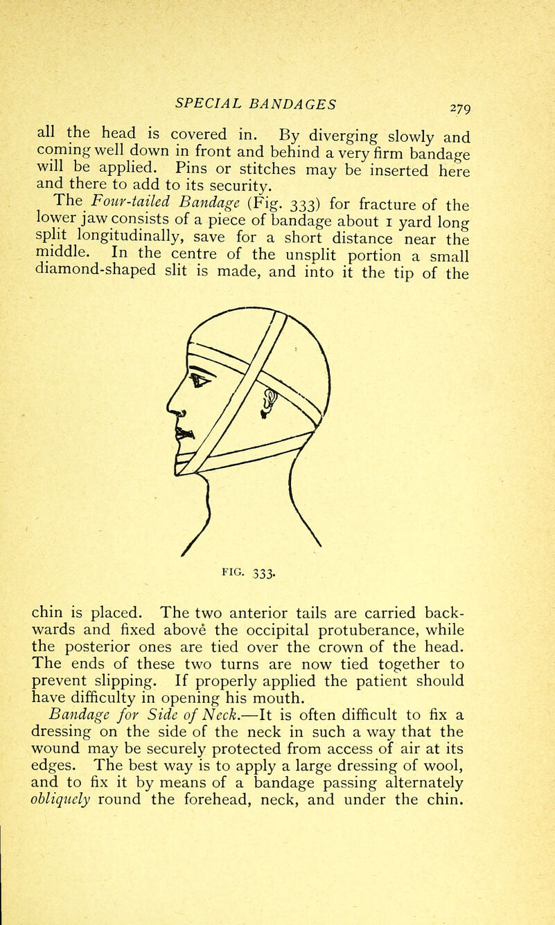 all the head is covered in. By diverging slowly and coming well down in front and behind a very firm bandage will be applied. Pins or stitches may be inserted here and there to add to its security. The_ Four-tailed Bandage (Fig. 333) for fracture of the lower jaw consists of a piece of bandage about i yard long split longitudinally, save for a short distance near the niiddle. In the centre of the unsplit portion a small diamond-shaped slit is made, and into it the tip of the FIG. 333. chin is placed. The two anterior tails are carried back- wards and fixed above the occipital protuberance, while the posterior ones are tied over the crown of the head. The ends of these two turns are now tied together to prevent slipping. If properly applied the patient should have difficulty in opening his mouth. Bandage for Side of Neck.—It is often difficult to fix a dressing on the side of the neck in such a way that the wound may be securely protected from access of air at its edges. The best way is to apply a large dressing of wool, and to fix it by means of a bandage passing alternately obliquely round the forehead, neck, and under the chin.