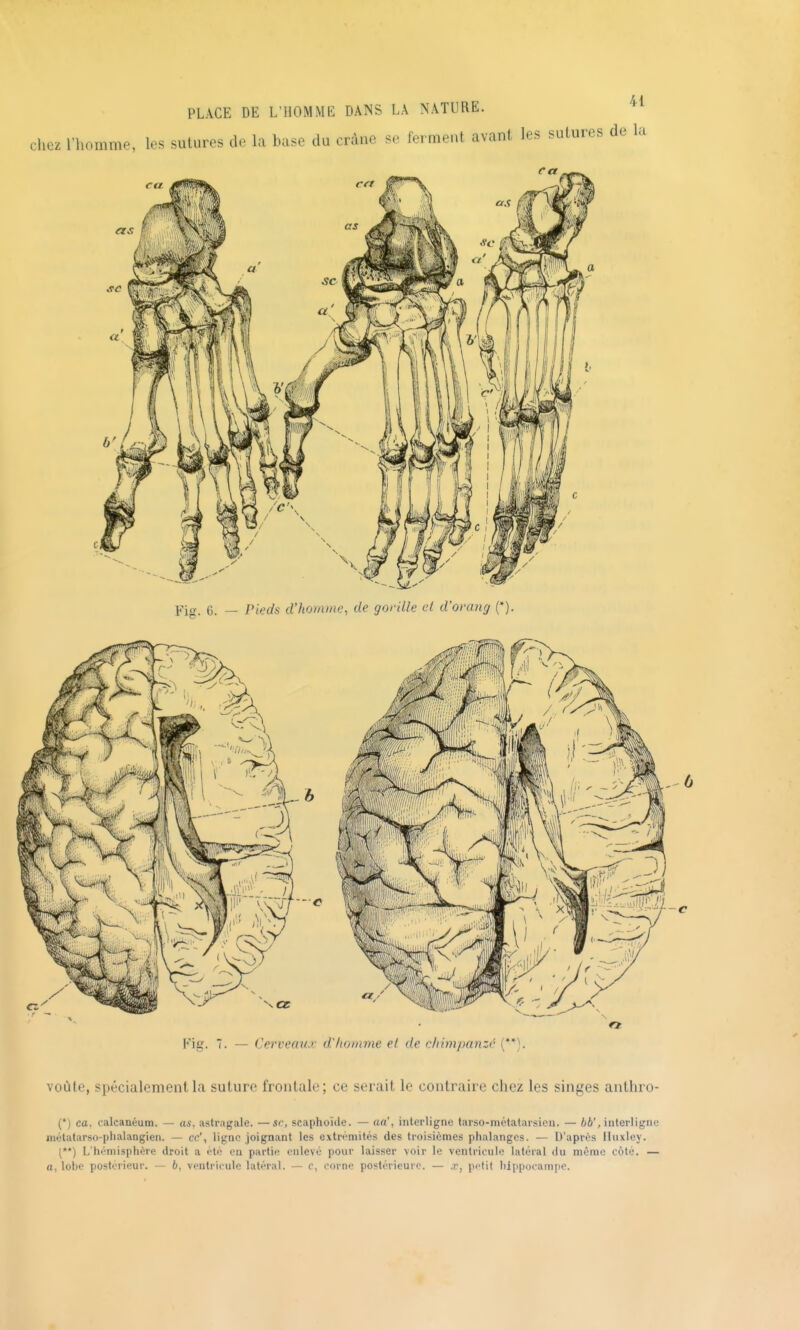 Fig. 6. — Pieds d'homme, de gorille et d'omng (*). voûte, spécialement la suture frontale; ce serait le contraire chez les singes antliro- (*) ca, calcanéum. — as, astragale. —se, scaphoïde. — aa\ interligne tarso-métatarsieii. — ôi', interligne niétatarso-plialangien. — ce', ligne joignant les extrémités des troisièmes phalanges. — D'après Huxley. (**) L'hémisphère droit a été en partie enlevé pour laisser voir le ventricule latéral du même côté. — a. lobe postérieur. — 6, ventricule latéral. — c, corne postérieure. — jc, iictit hippocampe.