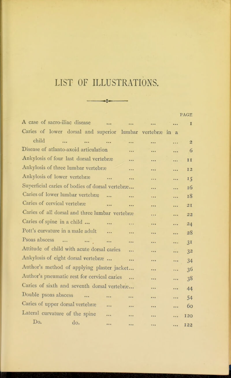 LIST OF ILLUSTRATIONS. ^ PAGE A case of sacro-iliac disease ... ... ... ... i Caries of lower dorsal and superior lumbar vertebrse in a child ... ... ... ... ... ... 2 Disease of atlanto-axoid articulation ... ... ... 6 Ankylosis of four last dorsal vertebrte ... ... ... n Ankylosis of three lumbar vertebn-e ... ... ... 12 Ankylosis of lower vertebrje ... ... ... ... Sui->erficial caries of bodies of dorsal vertebroe... ... ... 16 Caries of lower lumbar vertebrte ... ... ... ... ig Caries of cervical vertebrte ... ... ... 21 Caries of all dorsal and three lumbar vertebrte ... ... 22 Caries of spine in a child ... ... ... ... 24 Pott's curvature in a male adult ... ... ... ... 28 Psoas abscess ... ... ... ... ... Attitude of child with acute dorsal caries ... ... ... 32 Ankylosis of eight dorsal vertebrte ... ... ... ... ^4 Author's method of applying plaster jacket... ... ... 36 Author's pneumatic rest for cervical caries ... ... ... 38 Caries of sixth and seventh dorsal vertebrce... ... ... 44 Double psoas abscess ... ... ... ... ... Caries of upper dorsal vertebra: ... ... ... ... Lateral curvature of the spine ... ... ... ... 120 do. 122