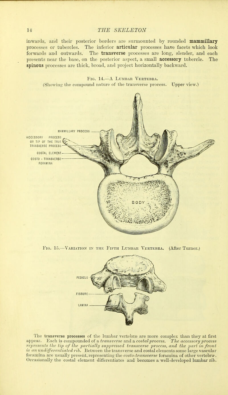 inwards, and their posterior borders are surmounted by rounded mammillary processes or tubercles. The inferior articular processes have facets which look forwards and outwards. The transverse processes are long, slender, and each presents near the base, on the posterior aspect, a small accessory tubercle. The spinous processes are thick, broad, and project horizontally backward. Fig. 14.—A Lumbar Vertebra. (Showing- the compound nature of the transverse iiroeess. Upper view.) A Fig. 15.—Variation in the Fifth Lumbar Vertebra. (After Tiufner.) The transverse processes of the lumbar vertebrae are more complex than they at first appear. Each is compoimded of a transverse and a costal2}rocess. The accessory process reijresents the tip of the piartially suppressed transverse process, and the piart in front is an undifferentiated rih. Between tlie transverse and costal elements some large vascular foramina are usually j)resent, representing the costo-transverse foramina of other vertebra-. Occasionally the costal element differentiates and becomes a well-developed lumbar rib.