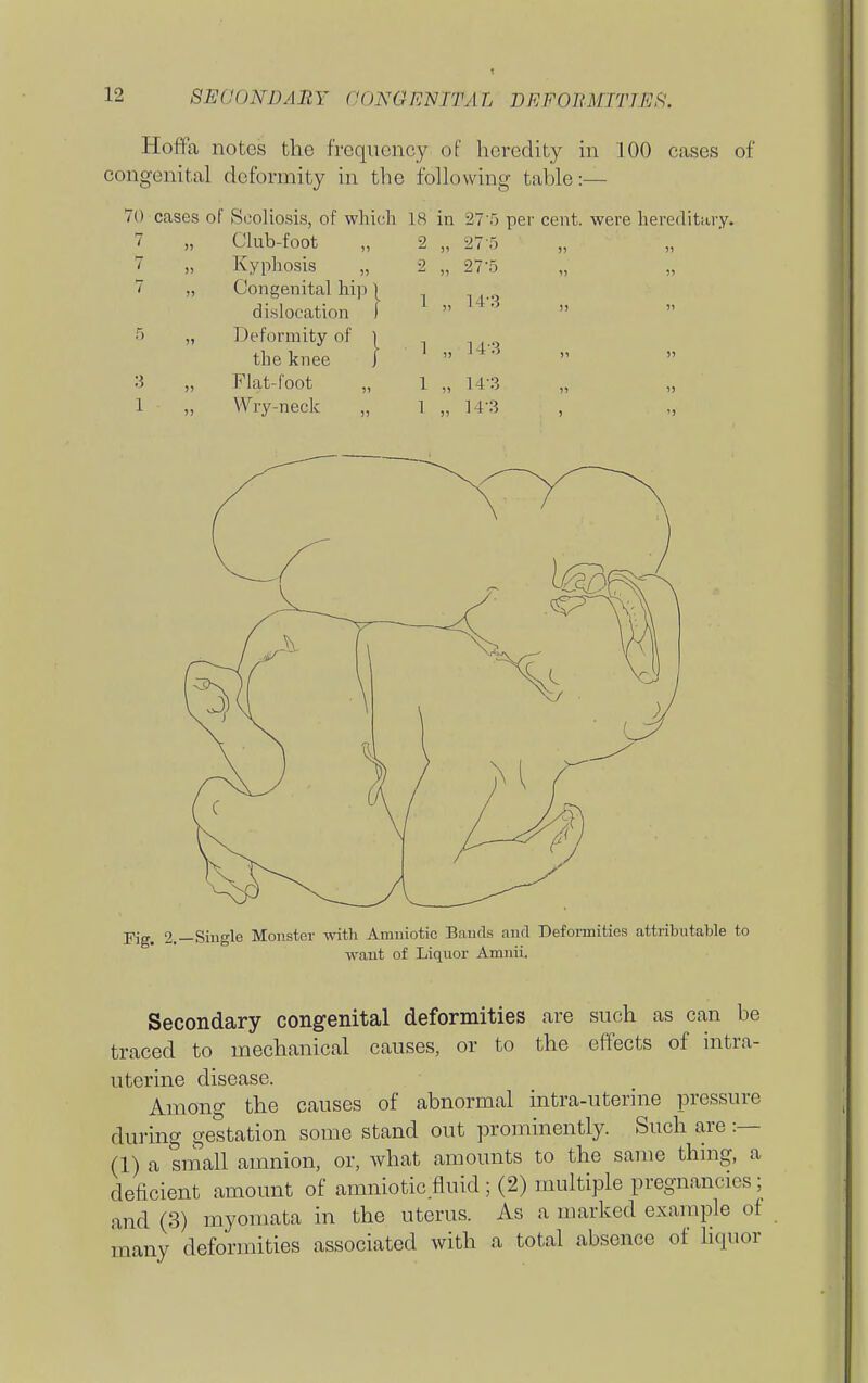 Hoffa notes the frequency of heredity in 100 cases of congenital deformity in the following table:— 70 cases of Scoliosis, of which 18 in '27 T) per cent, were hereditary. 7 „ Club-foot „ 2 „ 27-5 „ 7 „ Kyphosis „ 2 „ 27-5 „ 7 „ Congenital hip \ dislocation I ^  » 5 „ Deformity of 1 the knee | ' „ '-i-^ 3 „ Flat-foot „ 1 „ 14-3 1 „ Wry-neck „ 1 „ 14-3 , „ Yig, 2.—Single Monster with Amniotic Baucis and Defonnities attributable to want of Liquor Amnii. Secondary congenital deformities are such as can be traced to mechanical causes, or to the effects of intra- uterine disease. Among the causes of abnormal intra-uterine pressure during gestation some stand out prominently. Such are :— (1) a small amnion, or, what amounts to the same thing, a deficient amount of amniotic.fluid ; (2) multiple pregnancies; and (3) myomata in the uterus. As a marked example of many deformities associated with a total absence of Hquor