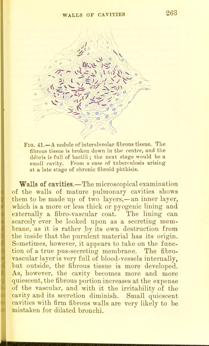 WALLS OP CAVITIES Fig. 41.—A nodule of interalveolar fibrous tissue. The fibrous tissue is broken down in tbe centre, and the debris is full of bacilli; the next stage would be a small cavity. From a case of tuberculosis arising at a late stage of chronic fibroid phthisis. Walls of cavities.—The microscopical examination of the walls of mature pulmonary cavities shows them to be made up of two layers,— an inner layer, which is a more or less thick or pyogenic lining and externally a fibro-vascular coat. The lining can scarcely ever be looked upon as a secreting mem- brane, as it is rather by its own destruction from the inside that the pi;rulent material has its origin. Sometimes, however, it appears to take on the func- tion of a true pus-secreting membrane. The fibro- vascular layer is very full of blood-vessels internally, but outside, the fibrous tissue is more developed. As, however, the cavity becomes more and more quiescent, tbe fibrous portion increases at the expense of the vascular, and with it the irritability of the cavity and its secretion diminish. Small quiescent cavities with firm fibrous walls are very likely to be mistaken for dilated bronchi.