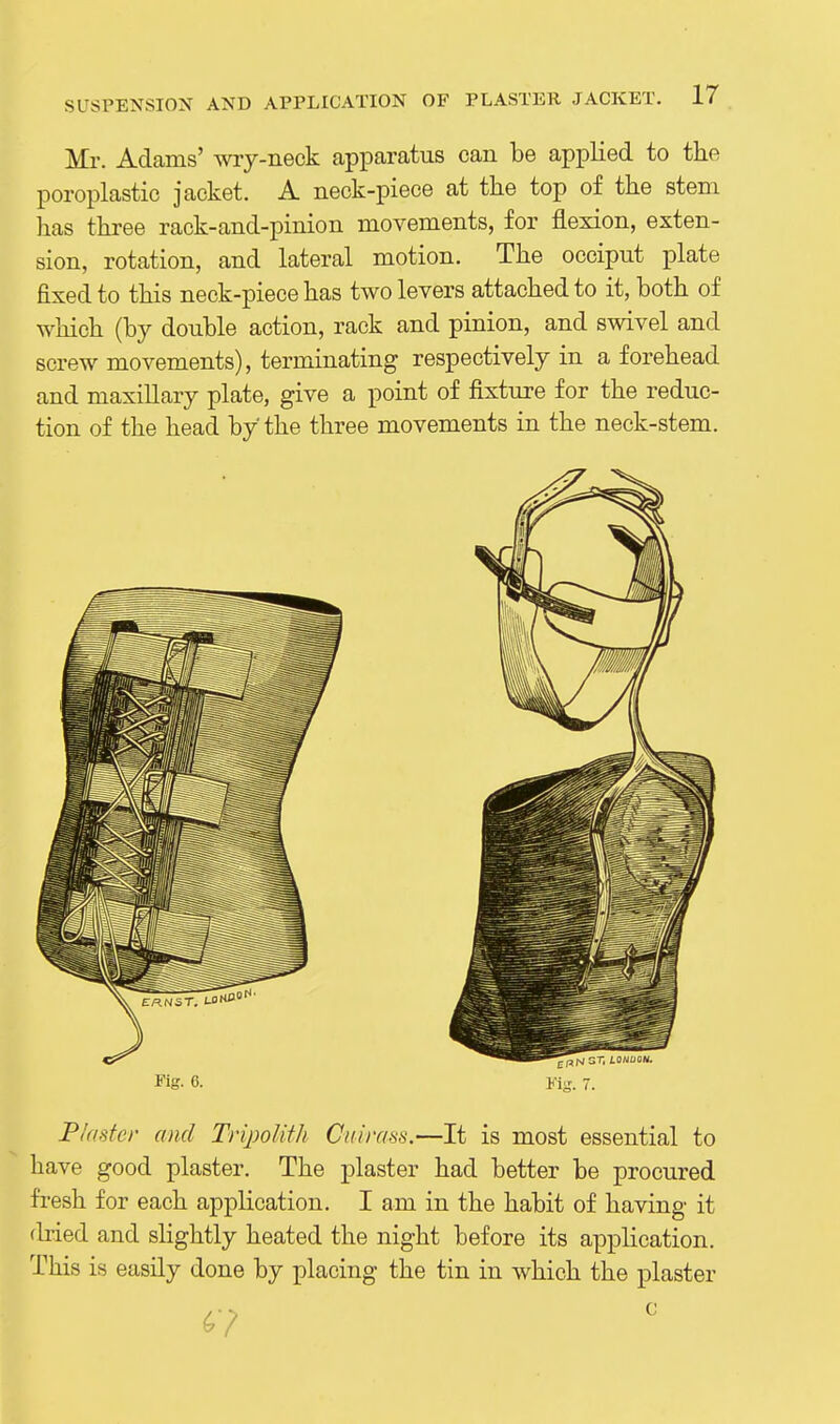 Mr. Adams' wry-neck apparatus can be applied to the poroplastic jacket. A neck-piece at the top of the stem has three rack-and-pinion movements, for flexion, exten- sion, rotation, and lateral motion. The occiput plate fixed to this neck-piece has two levers attached to it, both of which (by double action, rack and pinion, and swivel and screw movements), terminating respectively in a forehead and maxillary plate, give a point of fixture for the reduc- tion of the head by the three movements in the neck-stem. Fig- 6. Fig. 7. Plaster and TripoUfh Cuirass.—It is most essential to have good plaster. The plaster had better be procured fresh for each application. I am in the habit of having it rlried and shghtly heated the night before its application. This is easily done by placing the tin in which the plaster