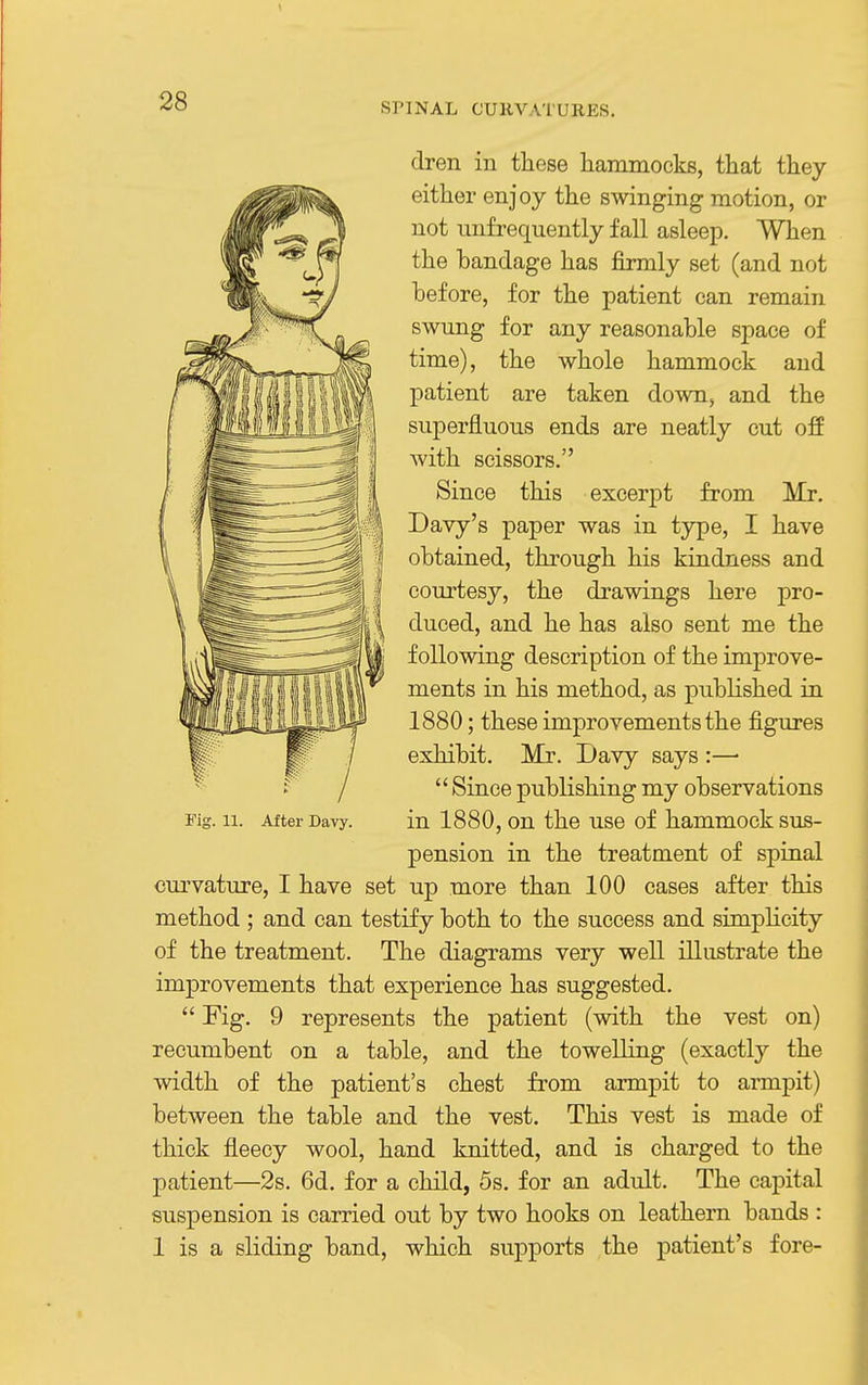 \ 28 SPINAL CURVATURES. dren in these hammocks, that they either enjoy the swinging motion, or not imfrequently fall asleep. When the bandage has firmly set (and not before, for the patient can remain swung for any reasonable space of time), the whole hammock and patient are taken down, and the superfluous ends are neatly cut off with scissors. Since this excerpt from Mr. Davy's paper was in type, I have obtained, through his kindness and courtesy, the drawings here pro- duced, and he has also sent me the following description of the improve- ments in his method, as published in 1880; these improvements the figures exhibit. Mr. Davy says :—•  Since publishing my observations in 1880, on the use of hammock sus- pension in the treatment of spinal curvature, I have set up more than 100 cases after this method ; and can testify both to the success and simplicity of the treatment. The diagrams very well illustrate the improvements that experience has suggested.  Fig. 9 represents the patient (with the vest on) recumbent on a table, and the towelling (exactly the width of the patient's chest from armpit to armpit) between the table and the vest. This vest is made of thick fieecy wool, hand knitted, and is charged to the patient—2s. 6d. for a child, 5s. for an adult. The capital suspension is carried out by two hooks on leathern bands : 1 is a sliding band, which supports ,the patient's fore- Fig. 11. After Davy.