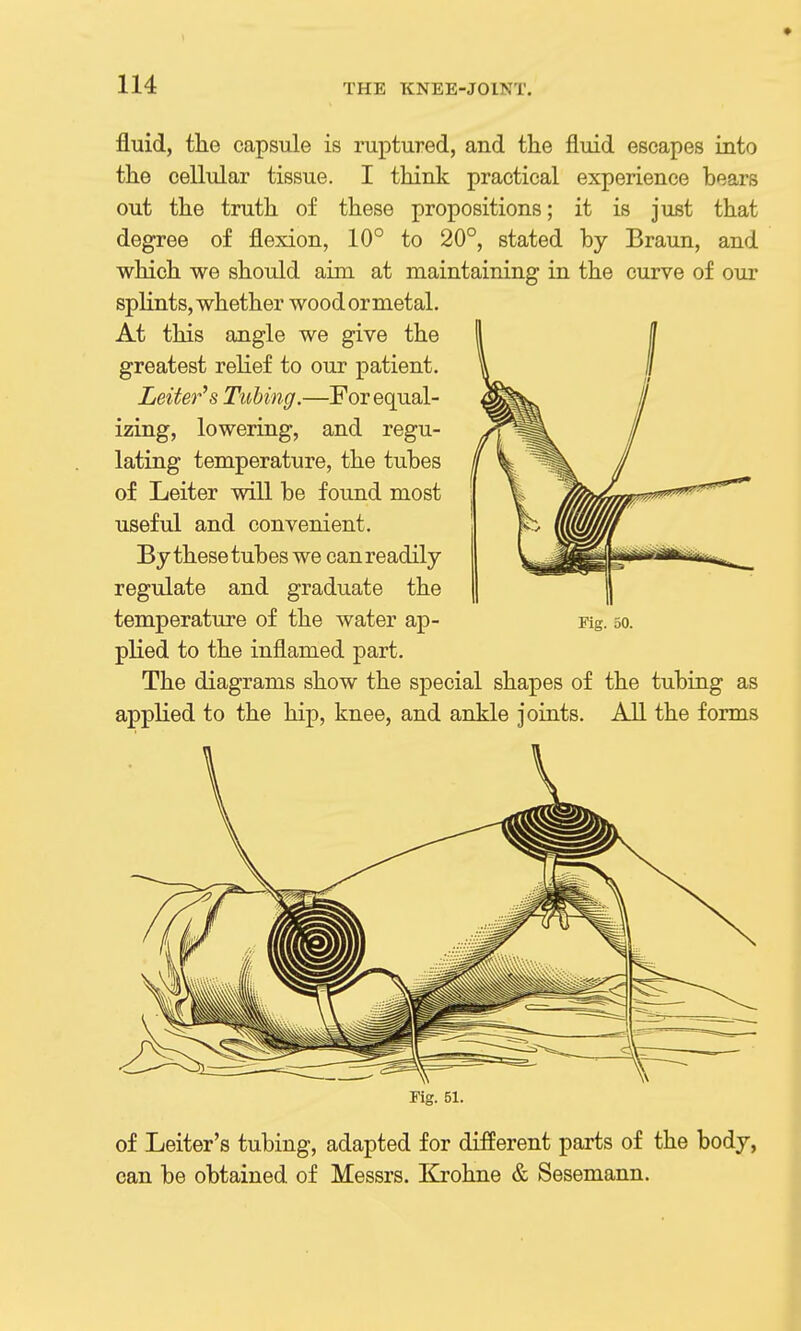 fluid, the capsule is ruptured, and the fluid escapes into the cellular tissue. I think practical experience bears out the truth of these propositions; it is just that degree of flexion, 10° to 20°, stated by Braun, and which we should aim at maintaining in the curve of our splints, whether wood or metal. At this angle we give the greatest relief to our patient. Leifer's Tubing.—For equal- izing, lowering, and regu- lating temperature, the tubes of Leiter will be found most useful and convenient. By these tubes we can readily regulate and graduate the temperature of the water ap- Fig. 50. plied to the inflamed part. The diagrams show the special shapes of the tubing as applied to the hip, knee, and ankle joiuts. All the forms Fig. 51. of Leiter's tubing, adapted for different parts of the body, can be obtained of Messrs. Kjohne & Sesemann.