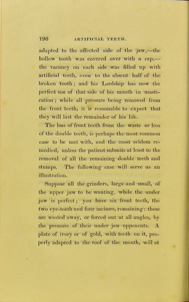 adapted to the affected side of the jaw,—the hollow tooth was covered over with a cap,— the vacancy on each side was filled up with artificial teeth, even to the absent half of the broken tooth ; and his Lordship has now the perfect use of that side of his mouth in masti- cation ; while all pressure being removed from the front teeth, it is reasonable to expect that they will last the remainder of his life. The loss of front teeth from the waste or loss of the double teeth, is perhaps the most common case to be met with, and the most seldom re- medied, unless the patient submits at least to the removal of all the remaining- double teeth and stumps. The following case will serve as an illustration. Suppose all the grinders, large and small, of the upper jaw to be wanting, while the under jaw is perfect^ you have six front teeth, the two eye-teeth and four incisors, remaining: these are wasted away, or forced out at all angles, by the pressure of their under jaw opponents. A plate of ivoiy or of gold, with teeth on it, pro- perly adapted to the roof of the mouth, will at