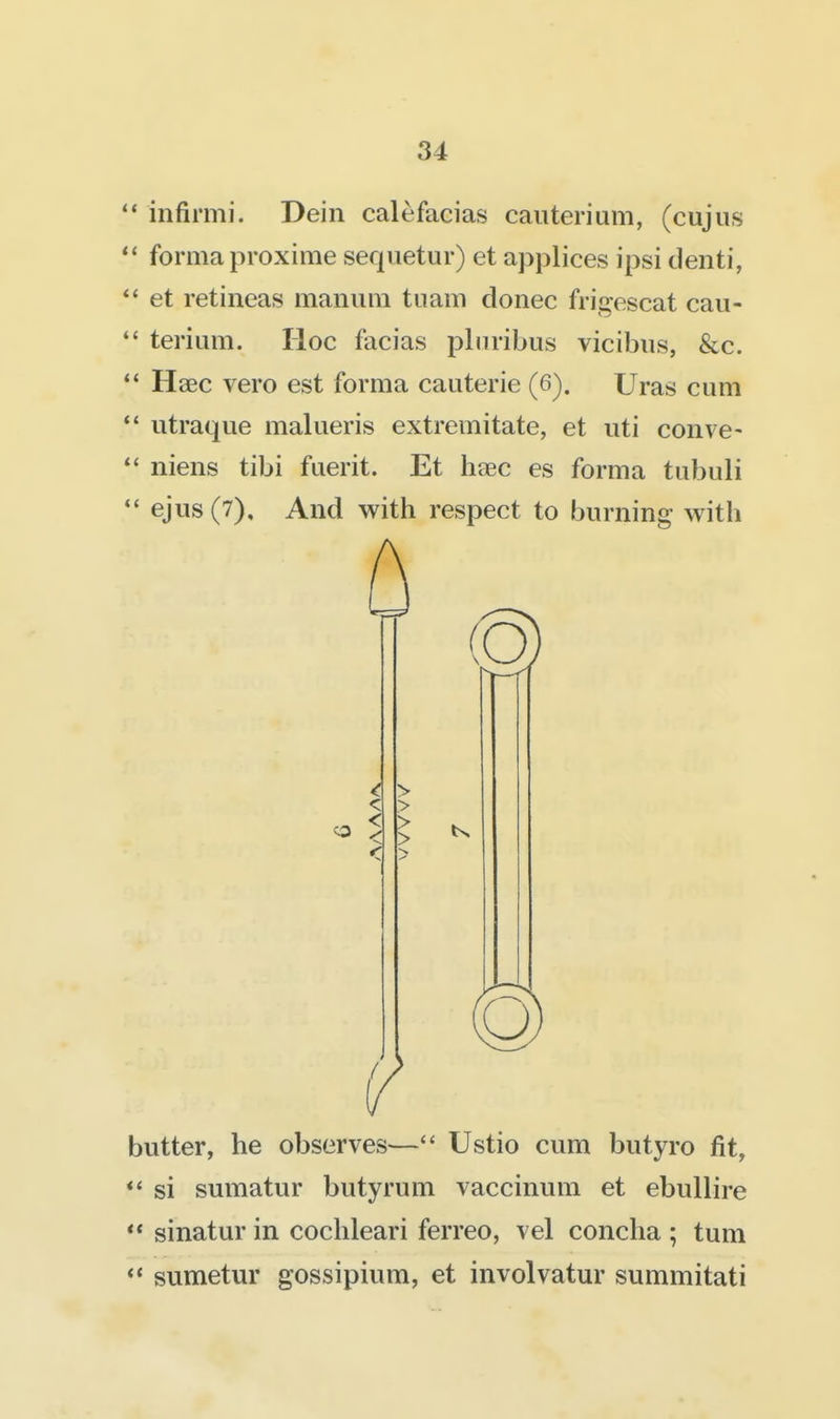 infirmi. Dein calefacias caiiterium, (cujus  forma proxime sequetur) et applices ipsi clenti, *' et retineas manuni tuam donee frigescat caii- *' terium. Hoc facias plnribus vicibus, &c. Haec vero est forma caiiterie (6). Uras cum utraque malueris extremitate, et uti conve- niens tibi fuerit. Et haec es forma tiibuli ejus (7), And with respect to burning with butter, he observes— Ustio cum butyro fit, *' si sumatur butyrum vaccinum et ebullire  sinatur in cochleari ferreo, vel concha ; turn *' sumetur gossipium, et involvatur summitati