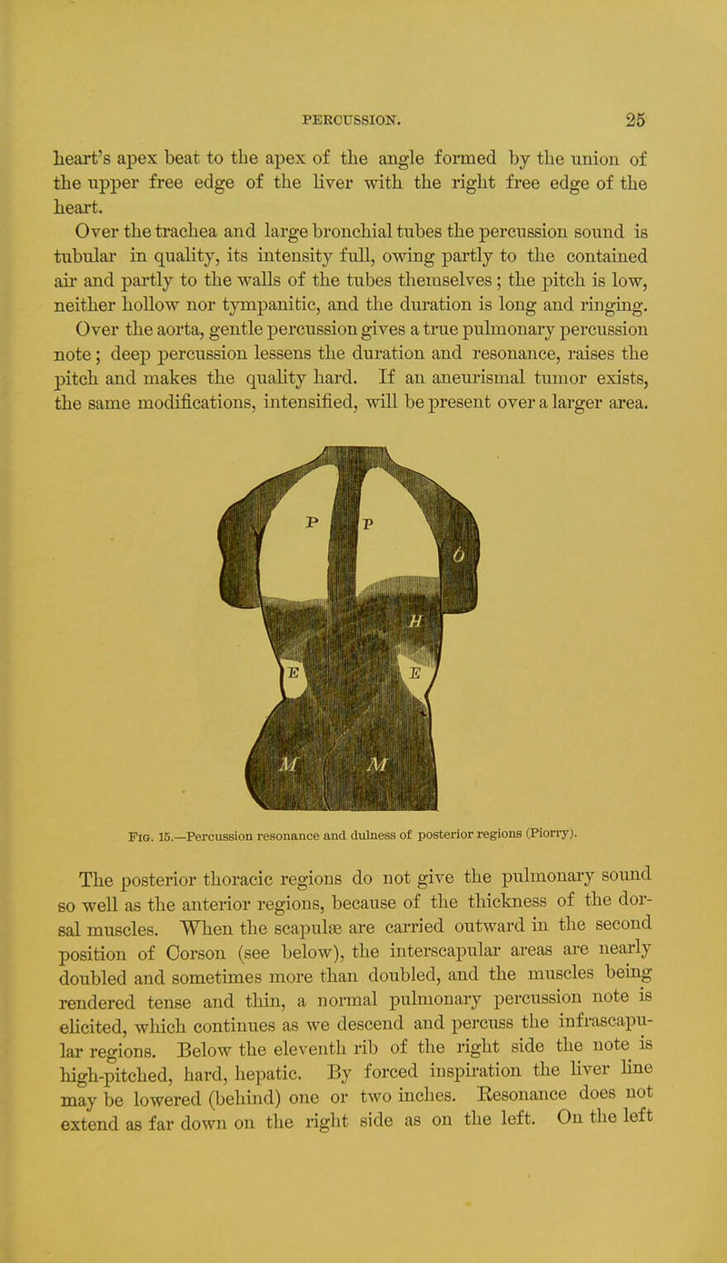 heart's apex beat to the apex of the angle foimed by the union of the upper free edge of the liver with the right free edge of the heai't. Over the trachea and large bronchial tubes the percussion soiind is tubular in quality, its intensity full, owing partly to the contained ail* and partly to the walls of the tubes themselves; the pitch is low, neither hollow nor tympanitic, and the duration is long and ringing. Over the aorta, gentle percussion gives a true pulmonary percussion note; deep percussion lessens the duration and resonance, raises the pitch and makes the quality hard. If an aneurismal tumor exists, the same modifications, intensified, vrill be present over a larger area. FiQ. 15.—Percussion resonance and dulness of posterior regions (Piorry). The posterior thoracic regions do not give the pulmonary sound so well as tlie anterior regions, because of the thickness of the dor- sal muscles. When the scapulae are carried outward in the second position of Corson (see below), the interscapular areas are nearly doubled and sometimes more than doubled, and the muscles berag rendered tense and thin, a normal pulmonary percussion note is elicited, which continues as we descend and percuss the infrascapu- lar regions. Below the eleventh rib of the right side the note is high-pitched, hard, hepatic. By forced inspiration the liver line may be lowered (behind) one or two inches. Kesonance does not extend as far down on the right side as on the left. On the left