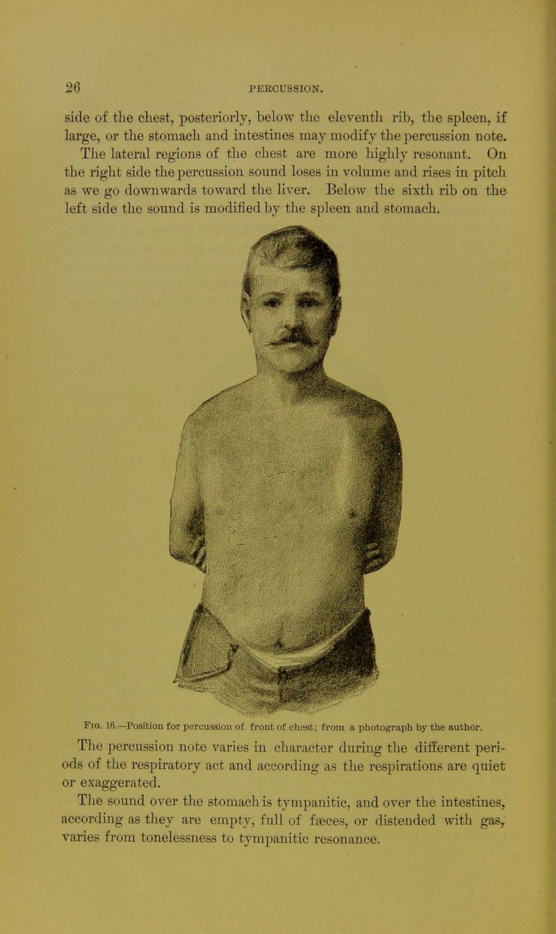 side of the chest, posteriorly, below the eleventh rib, the spleen, if large, or the stomach and intestines may modify the percussion note. The lateral regions of the chest are more highly resonant. On the right side the percussion sound loses in volume and rises in pitch as we go downwards toward the liver. Below the sixth rib on the left side the sound is modified by the spleen and stomach. Fig. 16.—Position for percussion of front of chest; from a photograph by the author. The percussion note varies in character during the different peri- ods of the respiratory act and according as the respirations are quiet or exaggerated. The sound over the stomach is tympanitic, and over the intestines^ according as they are empty, full of faeces, or distended with gas, varies from tonelessness to tympanitic resonance.