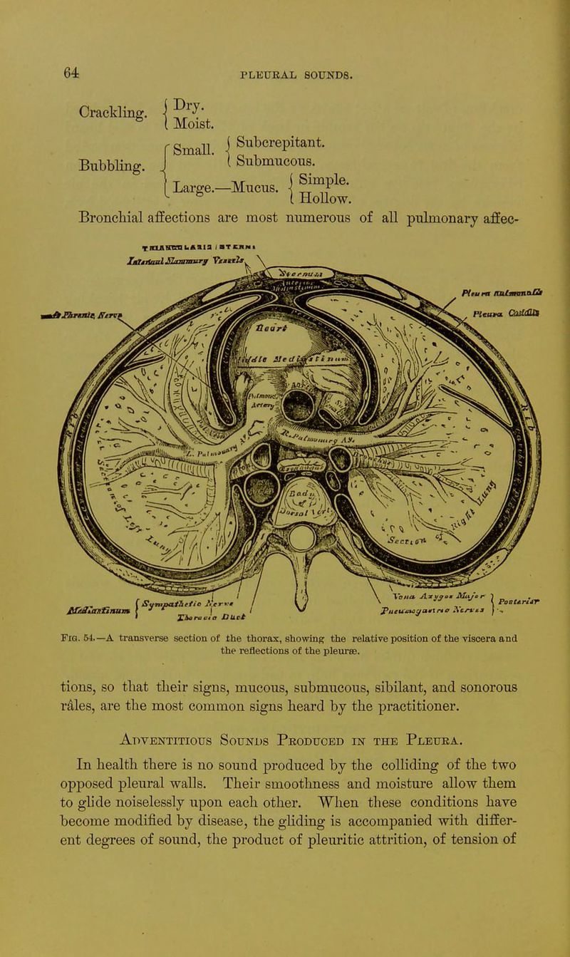 Crackling, -j ^ I Moist. Bubbling. Broncliial affections are most numerous of all pulmonary affec- 1 Small -I ^^^c^^P^^^^*' I Submucous. Large.-Mucus. \ ^^f^' ^ I HoUow. Pleura QnUtUM I SyTU^>at7l(fi'> ti.tr^-t XAerauia D Uct , I'titia. Axyaam Mui'cr 1 \ ' \ Pa Fig. 54.—A transverse section of the thorax, showing the relative position of the viscera and the reflections of the pleurae. tions, so tliat tlieir signs, mucous, submucous, sibilant, and sonorous rales, are the most common signs heard bj the practitioner. Adventitious Sounds Produced in the Pleura. In health there is no sound produced by the colliding of the two opjDOsed pleural walls. Their smoothness and moisture allow them to ghde noiselessly upon each other. When these conditions have become modified by disease, the gliding is accompanied with differ- ent degrees of sound, the product of pleuritic attrition, of tension of