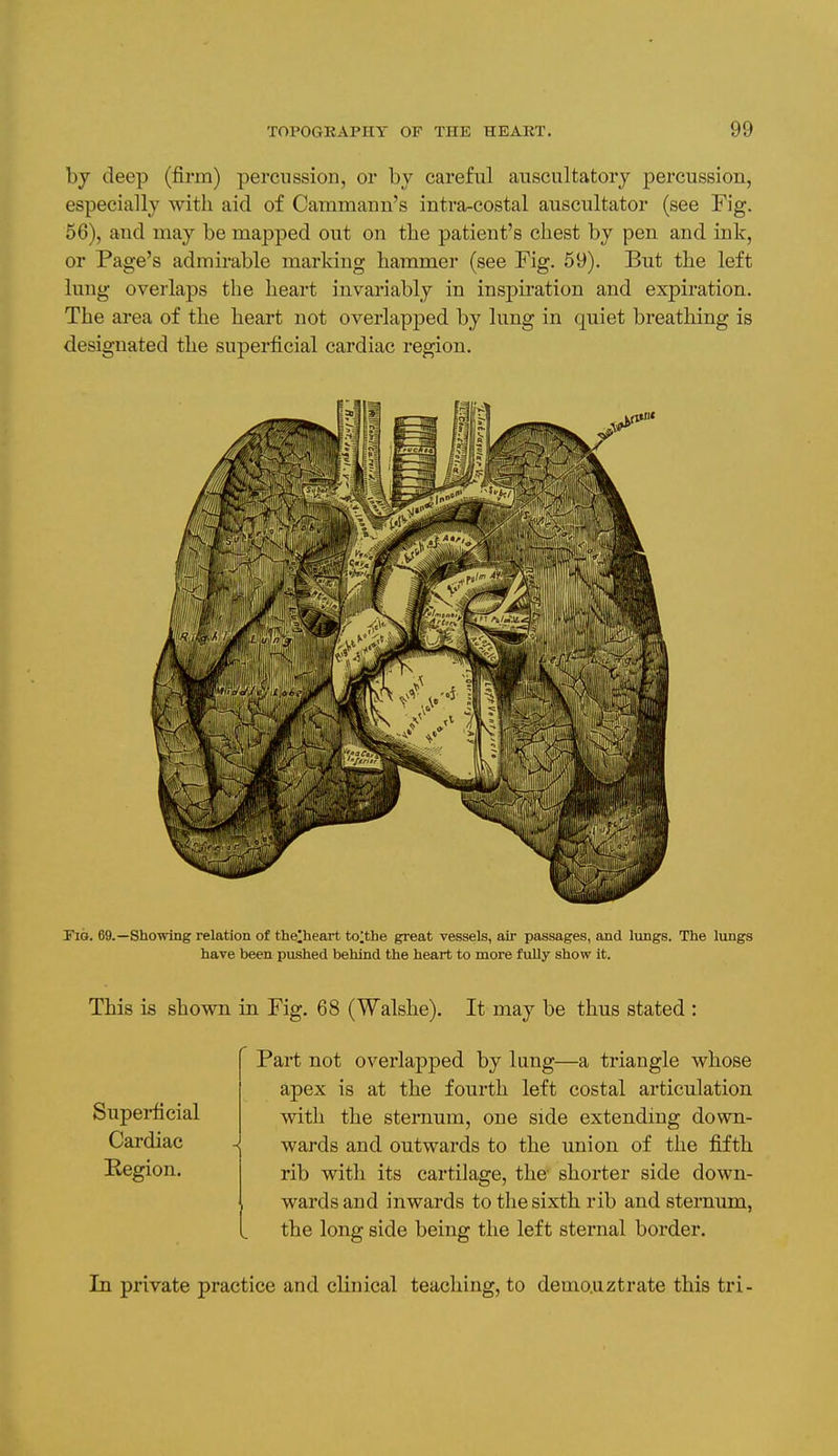 by deep (firm) percussion, or by careful auscultatory percussion, especially with aid of Cammann's intra-costal auscultator (see Fig. 56), and may be mapped out on the patient's chest by pen and ink, or Page's admirable marking hammer (see Fig. 59). But the left lung overlaps the heart invariably in inspiration and expiration. The area of the heart not overlapped by lung in quiet breathing is designated the superficial cardiac region. Tia. 69.—Showing relation of thelheart to;the great vessels, air passages, and lungs. The lungs have been pushed behind the heart to more fully show it. This is shown in Fig. 68 (Walshe). It may be thus stated : Superficial Cardiac Region. Part not overlapped by lung—a triangle whose apex is at the fourth left costal articulation with the sternum, one side extending down- wards and outwards to the union of the fifth rib with its cartilage, the shorter side down- wards and inwards to the sixth rib and sternum, the long side being the left sternal border. In private practice and clinical teaching, to demo.uztrate this tri-