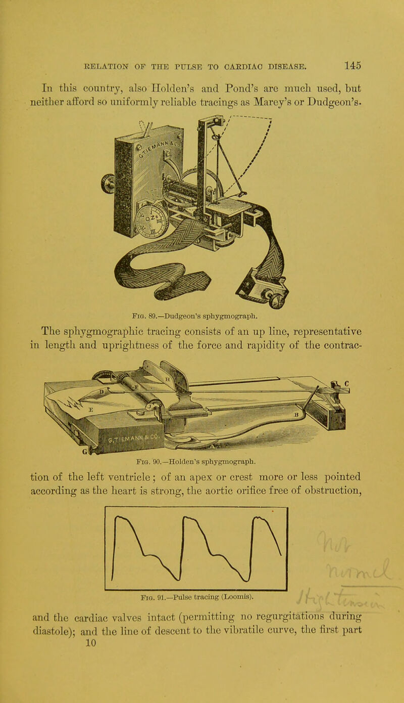 In this country, also Ilolden's and Pond's are mucli used, but neither afford so uniformly reliable tracings as Marey's or Dudgeon's- Fig. 89.—Dudgeon's sphygmograph. The spliygmographic tracing consists of an up line, representative in length and uprightness of the force and rapidity of tlie contrac- FiG. 90.—Holden's sphygmograph. tion of the left ventricle ; of an apex or crest more or less pointed according as the heart is strong, the aortic orifice free of obstruction, FiQ. 91.—Pulse tracing (Loomis). and the cardiac valves intact (permitting no regurgitations during diastole); and the line of descent to the vibratile curve, the first part 10