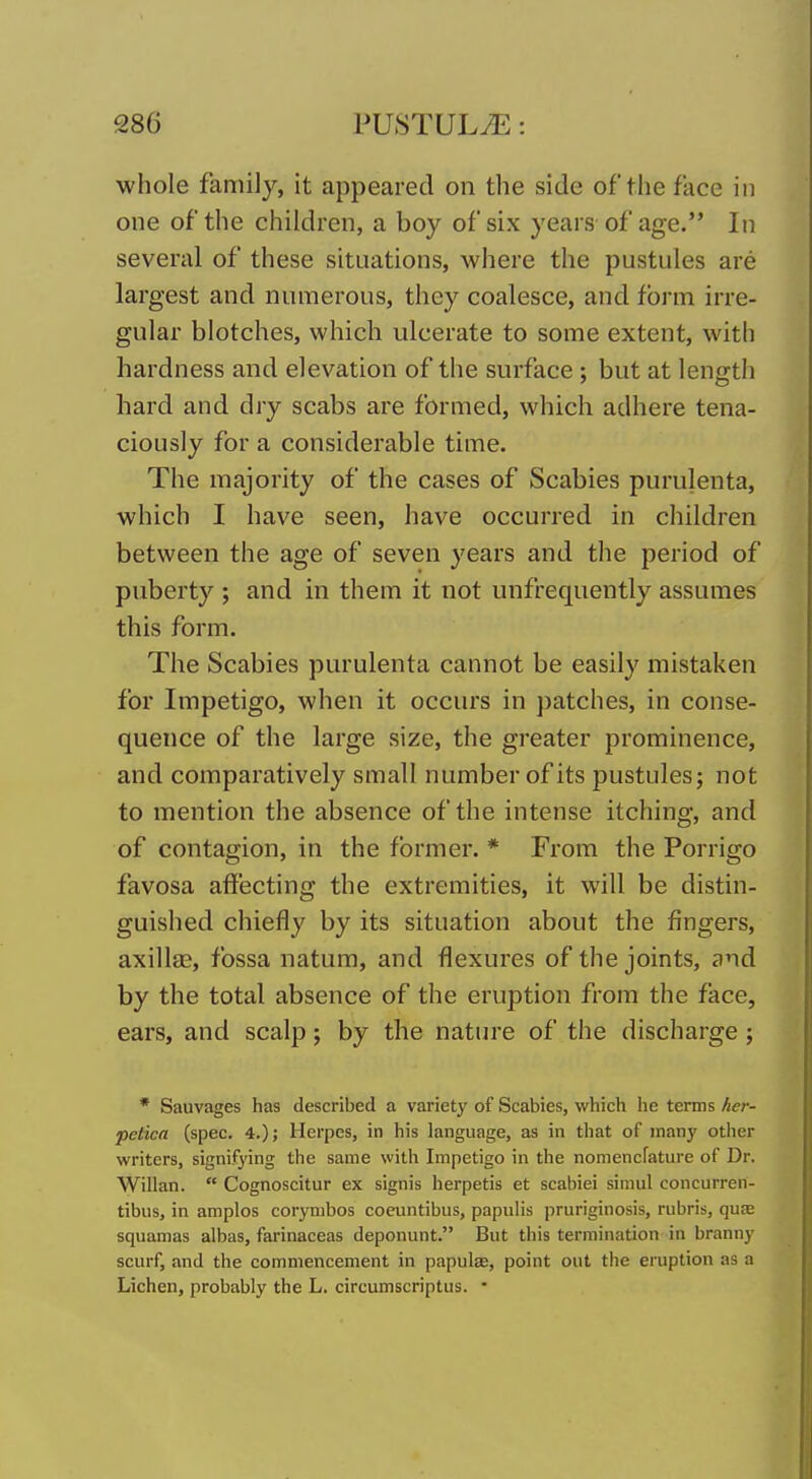 whole family, it appeared on the side of the face in one of the children, a boy of six years of age. In several of these situations, where the pustules are largest and numerous, they coalesce, and fbi-m irre- gular blotches, which ulcerate to some extent, with hardness and elevation of the surface; but at length hard and dry scabs are formed, which adhere tena- ciously for a considerable time. The majority of the cases of Scabies purulenta, which I have seen, have occurred in children between the age of seven years and the period of puberty ; and in them it not unfrequently assumes this form. The Scabies purulenta cannot be easily mistaken for Impetigo, when it occurs in patches, in conse- quence of the large size, the greater prominence, and comparatively small number of its pustules; not to mention the absence of the intense itching, and of contagion, in the former. * From the Porrigo favosa affecting the extremities, it will be distin- guished chiefly by its situation about the fingers, axillas, fossa natum, and flexures of the joints, and by the total absence of the eruption from the face, ears, and scalp; by the natin'e of the discharge ; * Sauvages has described a variety of Scabies, which he terms her- petica (spec. 4.) J Herpes, in his language, as in that of many other writers, signifying the same with Impetigo in the nomencfature of Dr. Willan.  Cognoscitur ex signis herpetis et scabiei simul concurren- tibus, in amplos corynibos coeuntibus, papuHs pruriginosis, rubris, quse squamas albas, farinaceas deponunt. But this termination in branny scurf, and the commencement in papulee, point out the eruption as a Lichen, probably the L. circumscriptus. •