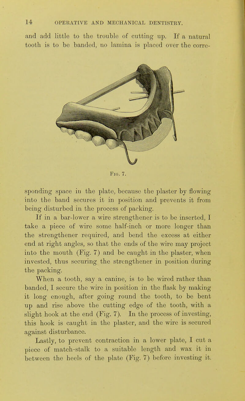 and add little to the trouble of cutting up. If a natural tooth is to be banded, no lamina is placed over the corre- FiG. 7. spending space in the plate, because the plaster by flowing into the band secures it in position and prevents it from being disturbed in the process of packing. If in a bar-lower a wire strengthener is to be inserted, I take a piece of wire some half-inch or more longer than the strengthener required, and bend the excess at either end at right angles, so that the ends of the wire may project into the mouth (Fig. 7) and be caught in the plaster, when invested, thus securing the strengthener in position during the packing. When a tooth, say a canine, is to be wired rather than banded, I secure the wire in position in the flask by making it long enough, after going round the tooth, to be bent up and rise above the cutting edge of the tooth, with a slight hook at the end (Fig. 7). In the process of investing, this hook is caught in the plaster, and the wire is secured against disturbance. Lastly, to prevent contraction in a lower plate, I cut a piece of match-stalk to a suitable length and wax it in between the heels of the plate (Fig. 7) before investing it.